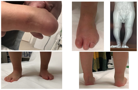 Osteology 05 00021 g004