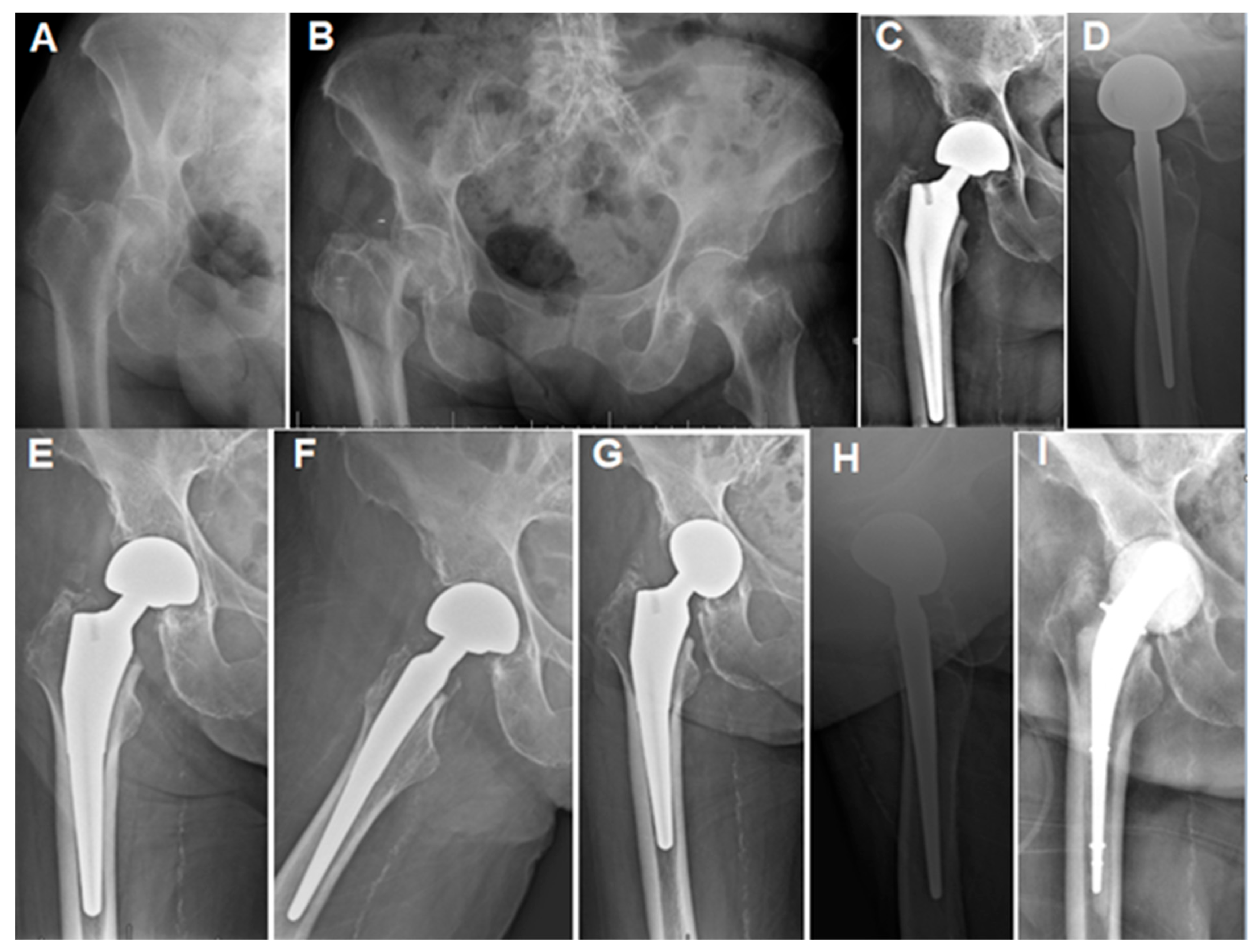 Osteology 05 00027 g003 Osteology 05 00027 g003