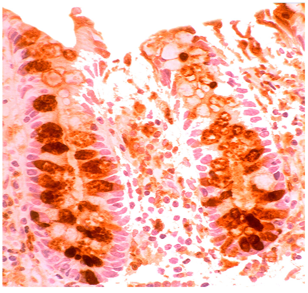 Pathogens 03 00073 g011 1024