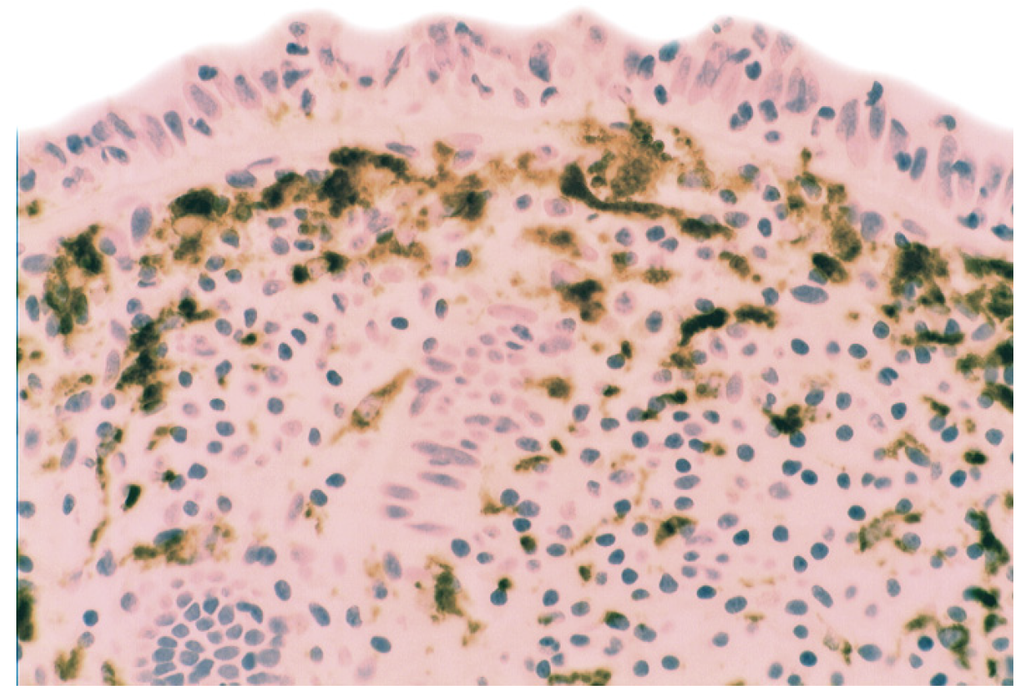 Pathogens 03 00073 g012 1024