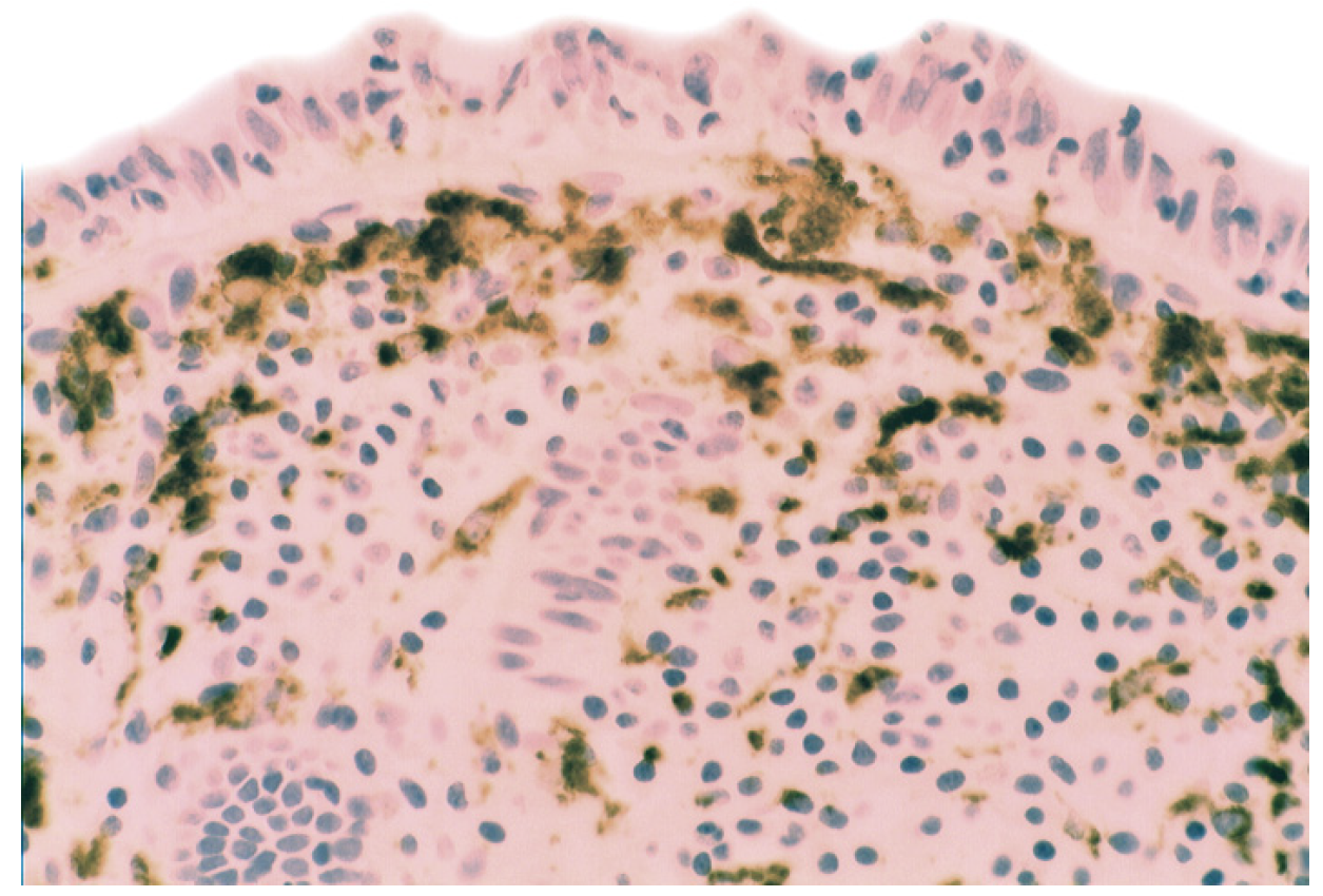 Pathogens 03 00073 g012