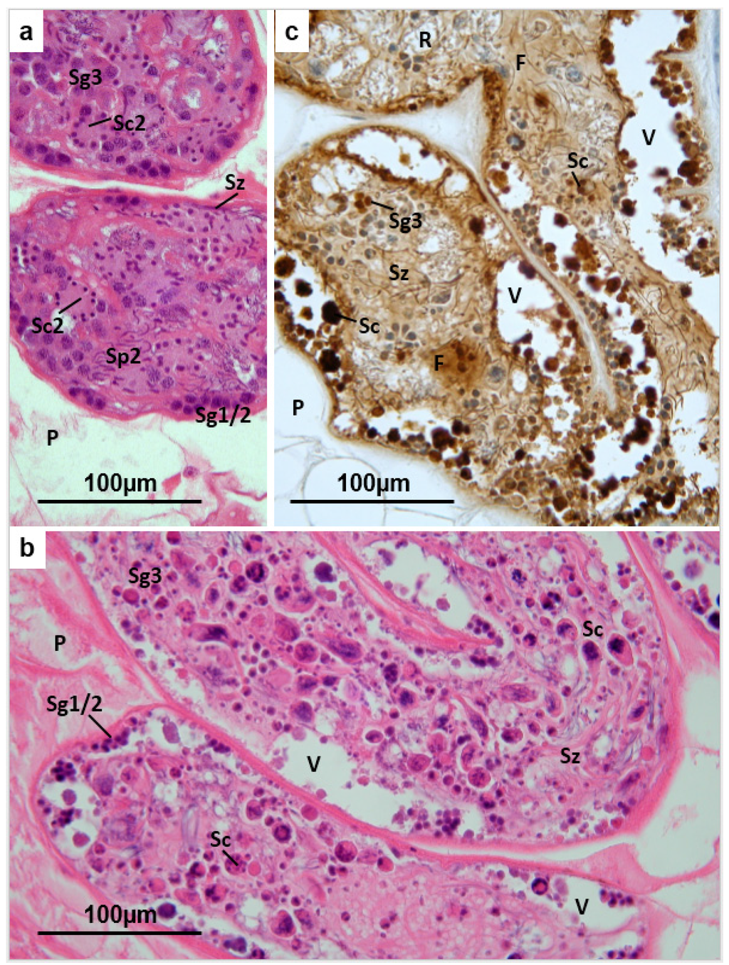 Pathogens 04 00431 g003 1024