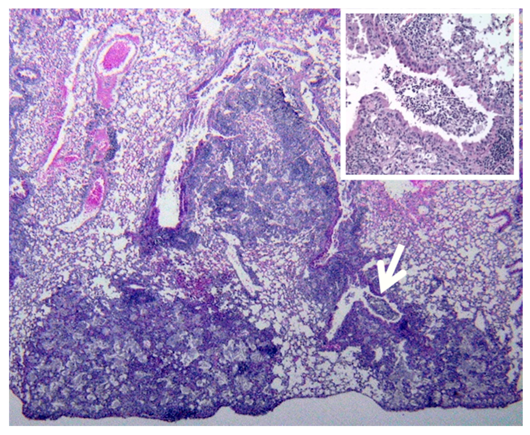 Pathogens 07 00019 g006