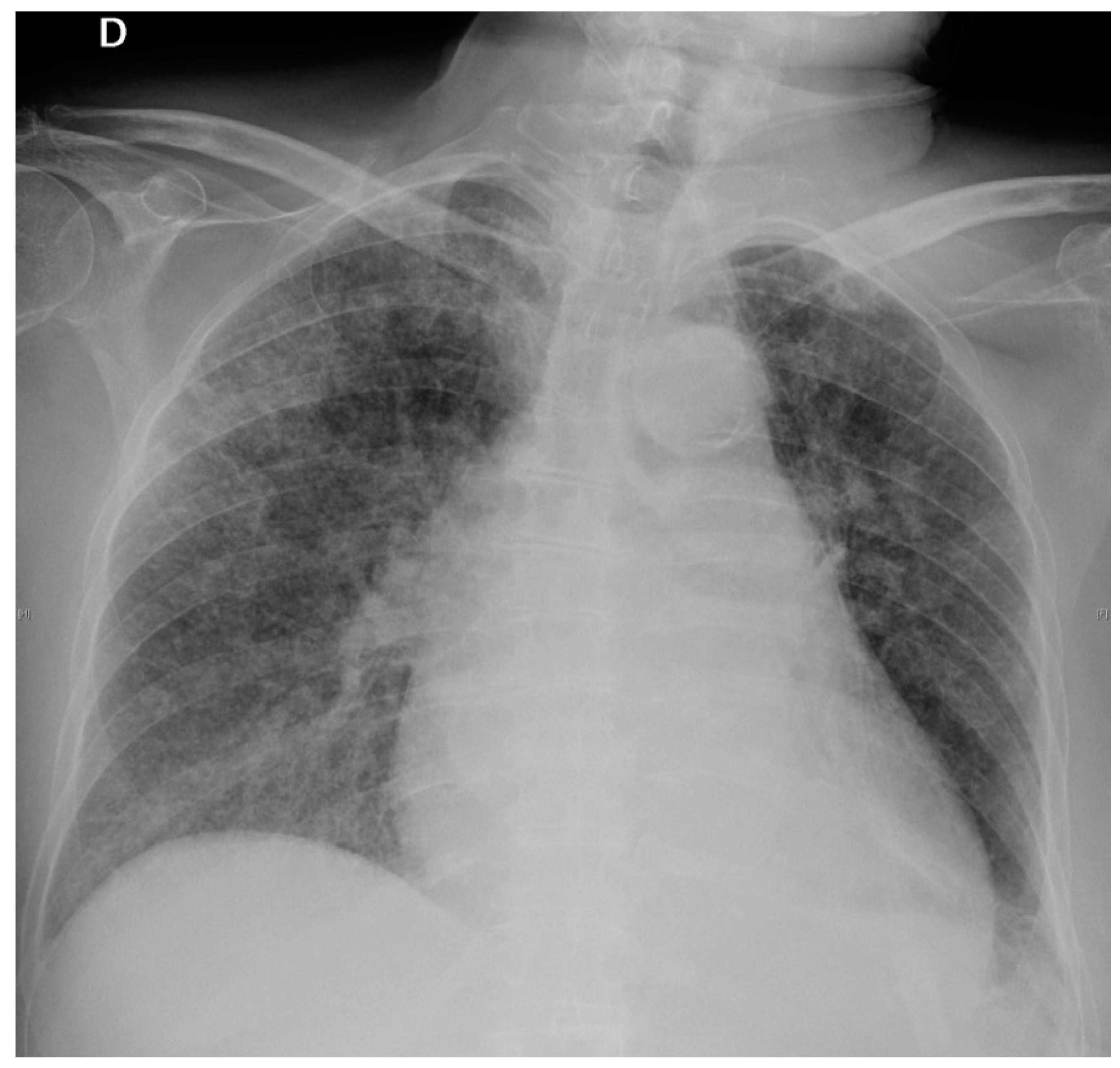 Pathogens 07 00072 g002 Pathogens 07 00072 g002