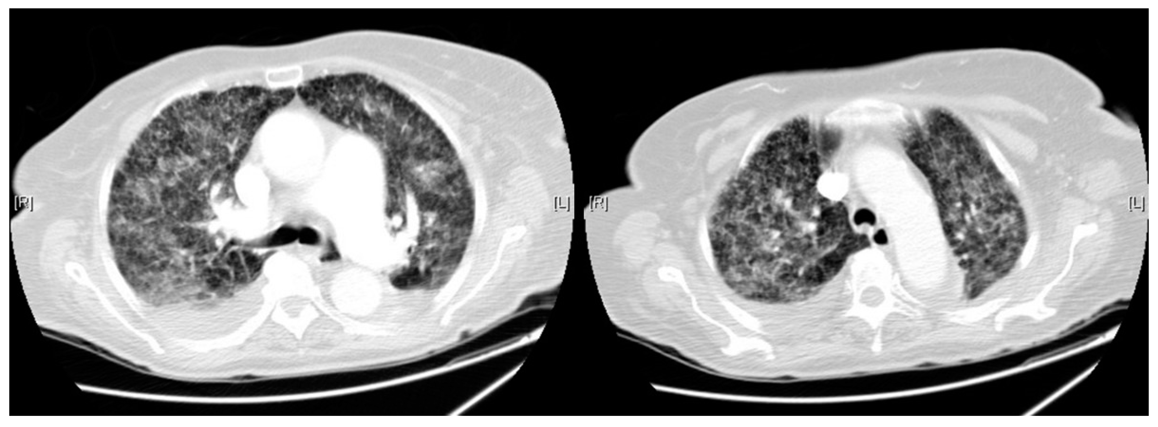 Pathogens 07 00072 g003 Pathogens 07 00072 g003