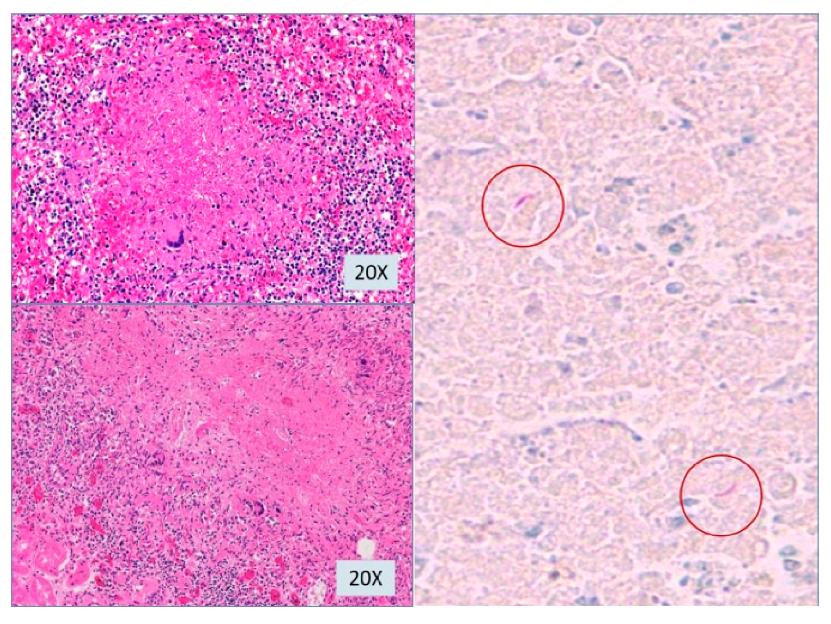 Pathogens 07 00072 g006 Pathogens 07 00072 g006