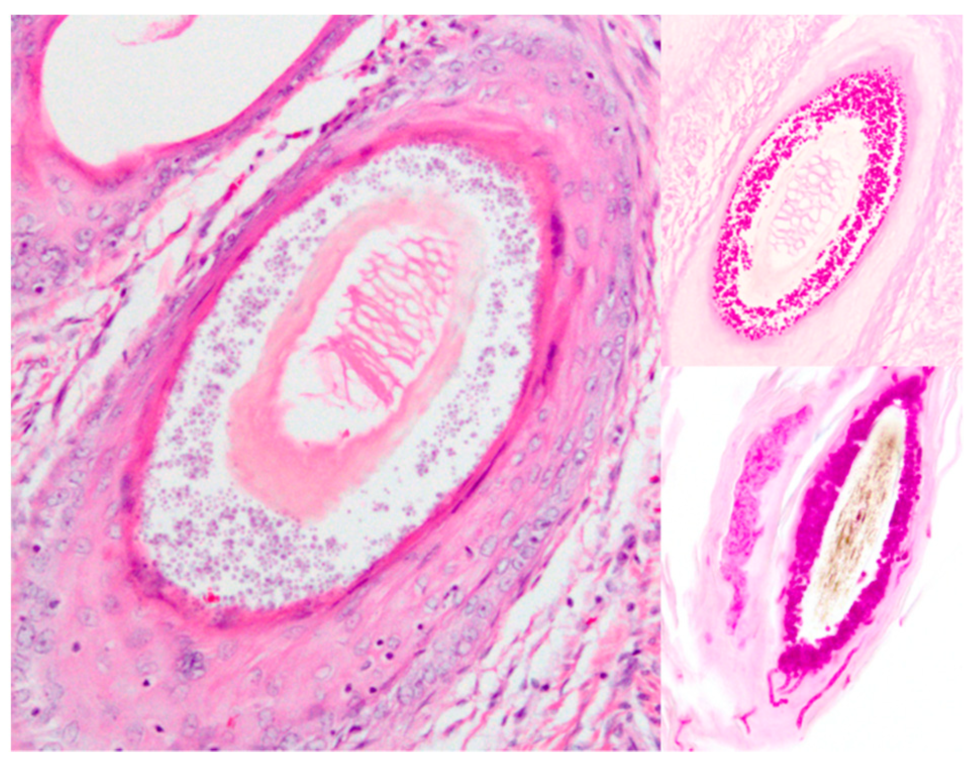 Pathogens 08 00171 g004