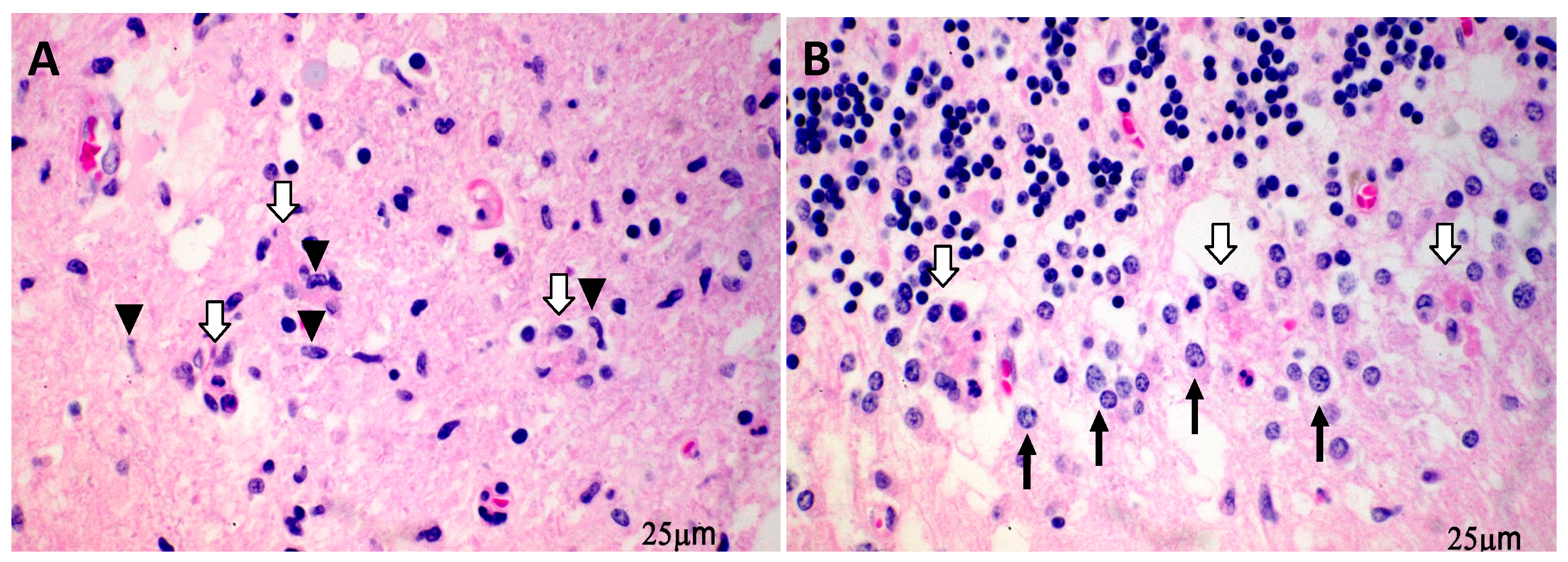 Pathogens 08 00215 g001