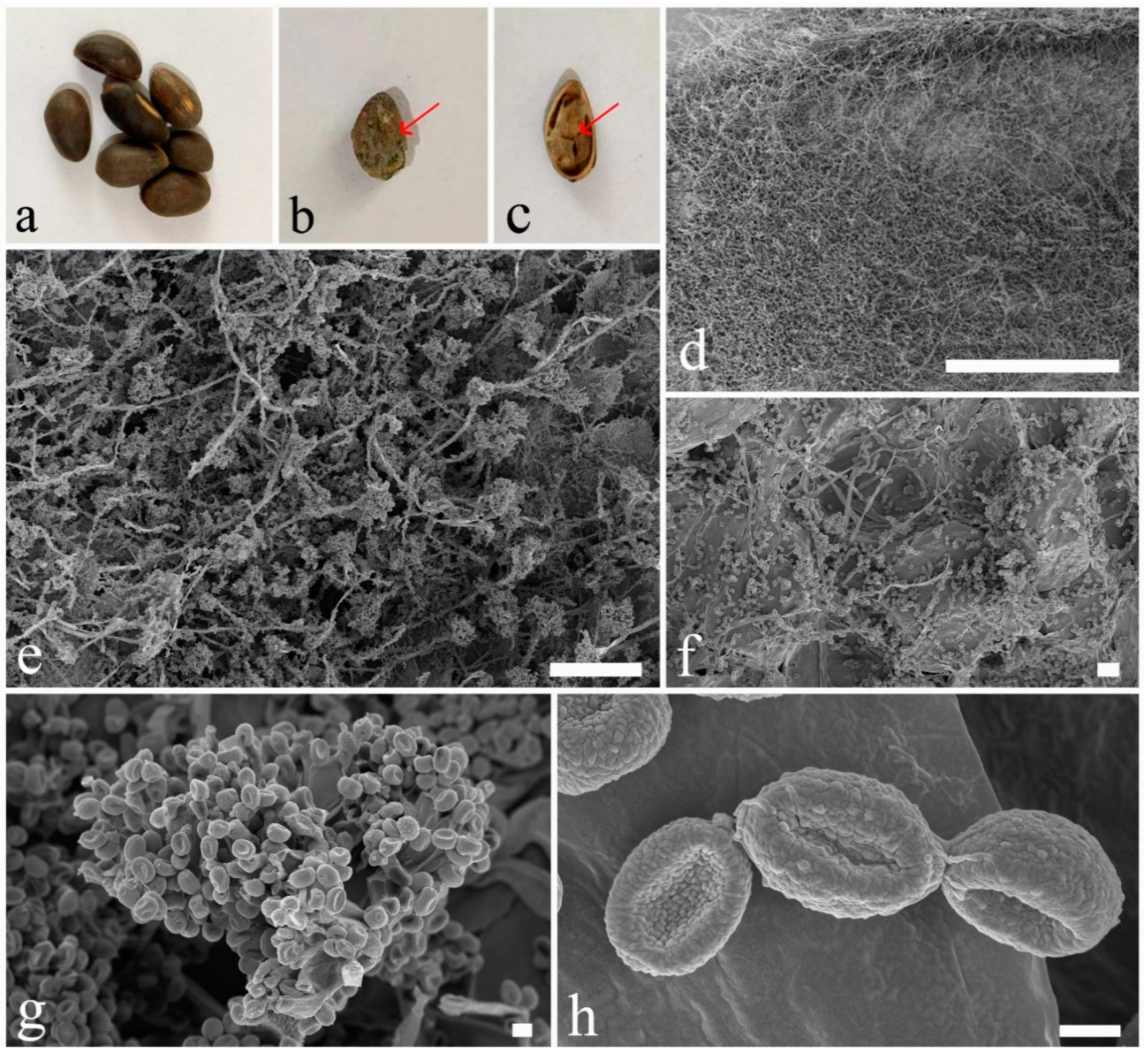 Pathogens 08 00285 g001