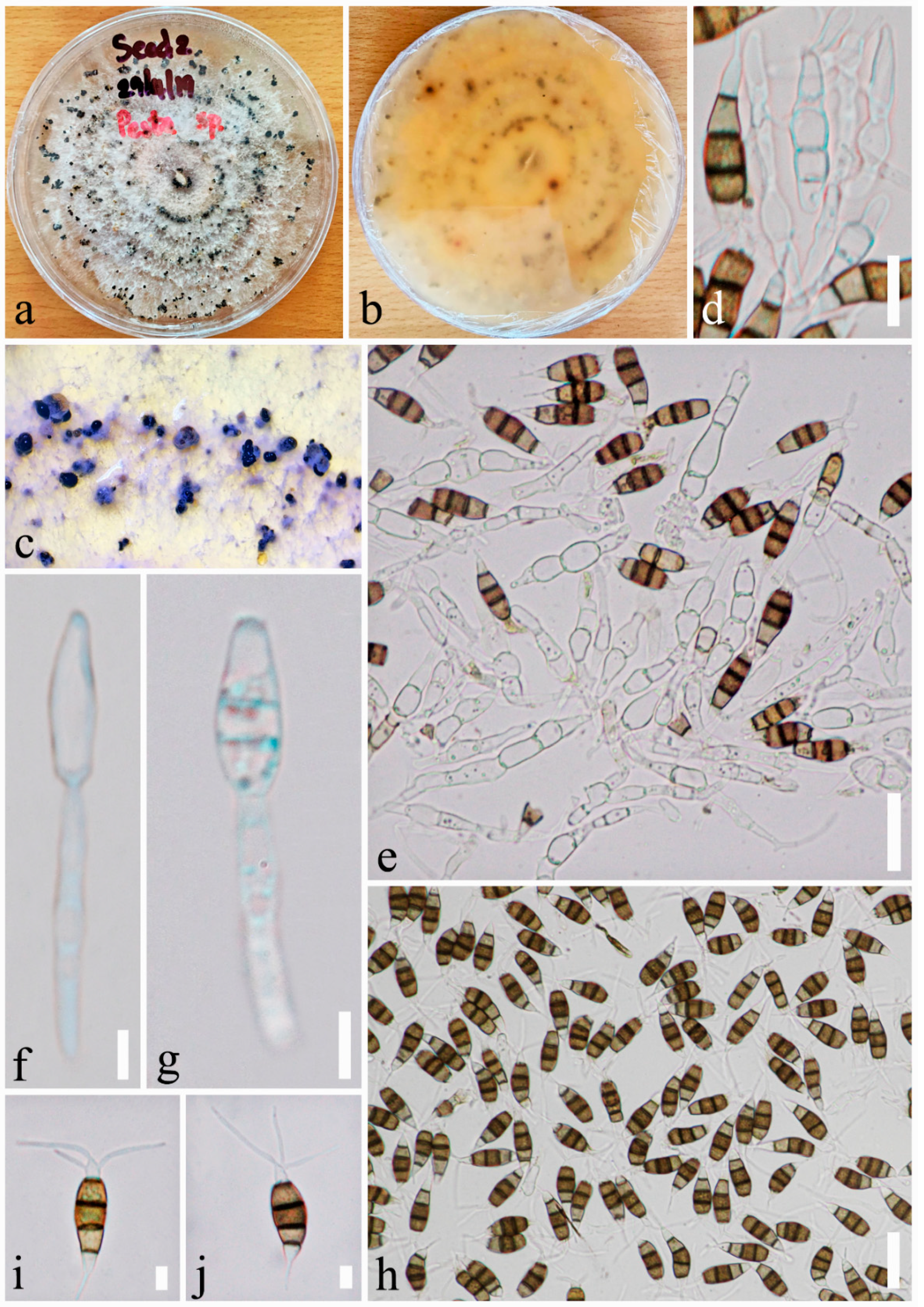 Pathogens 08 00285 g005