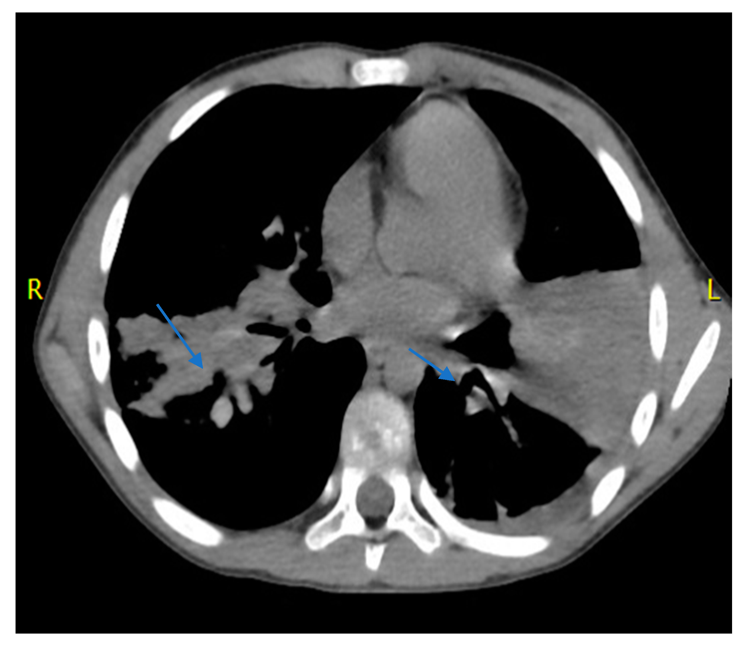 Pathogens 09 00015 g001