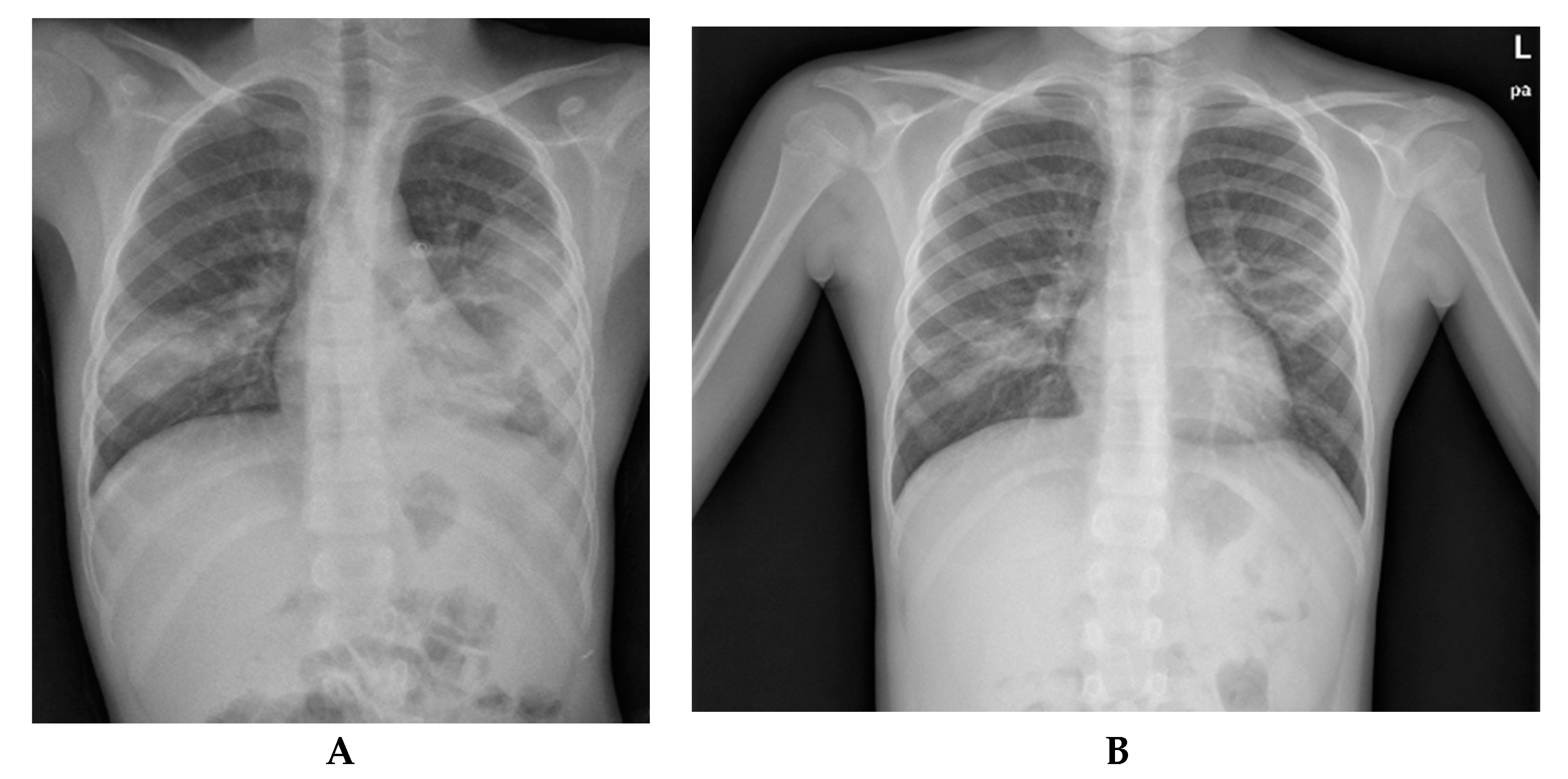 Pathogens 09 00015 g002