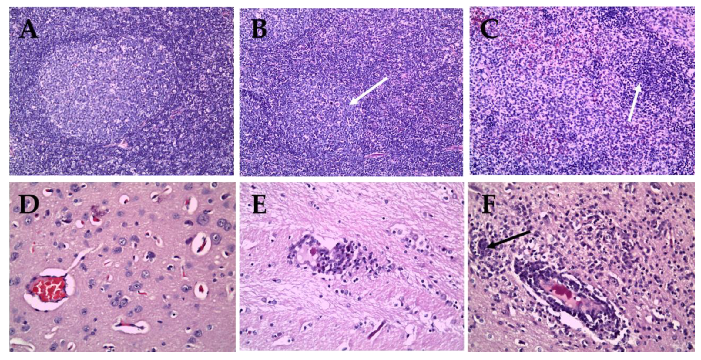 Pathogens 09 00169 g004