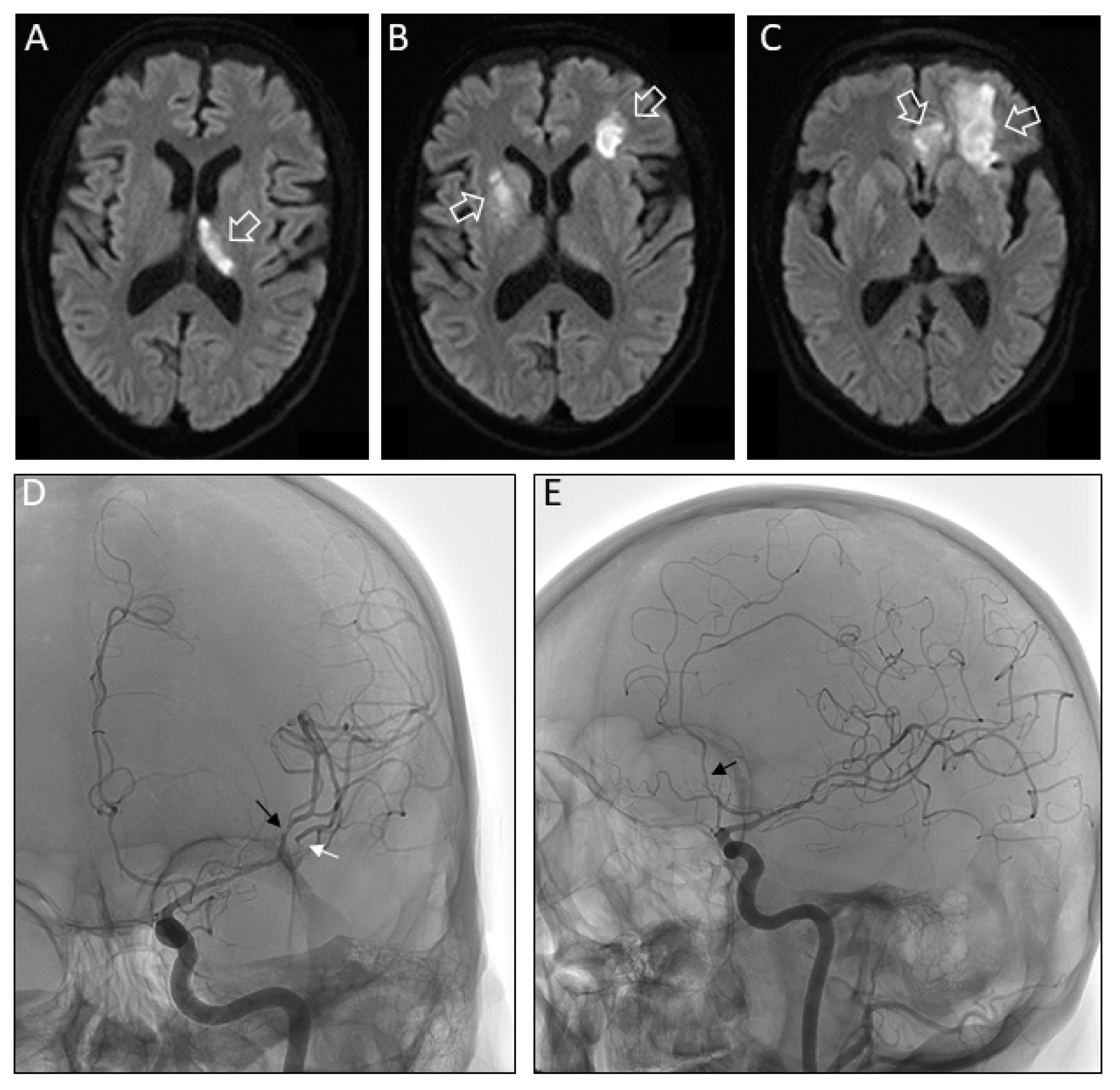 Pathogens 09 00193 g002
