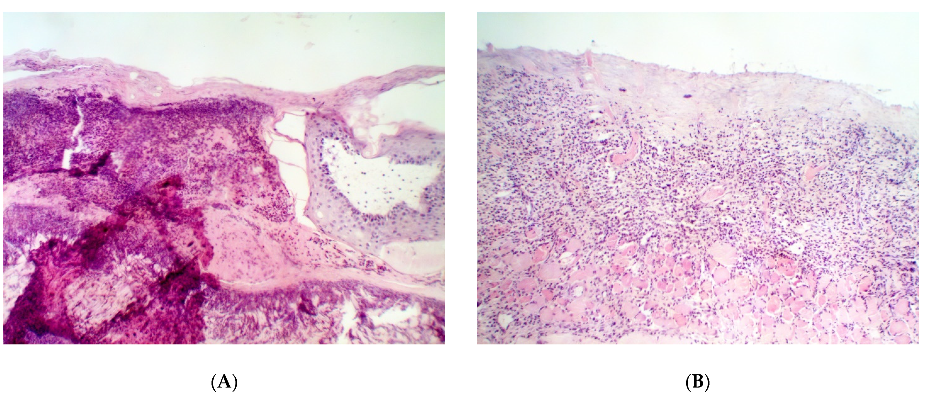 Pathogens 09 00296 g003a