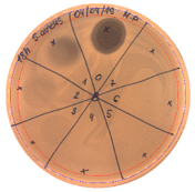 Pathogens 09 00319 i004