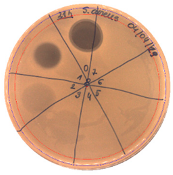 Pathogens 09 00319 i005