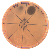 Pathogens 09 00319 i007