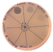 Pathogens 09 00319 i018