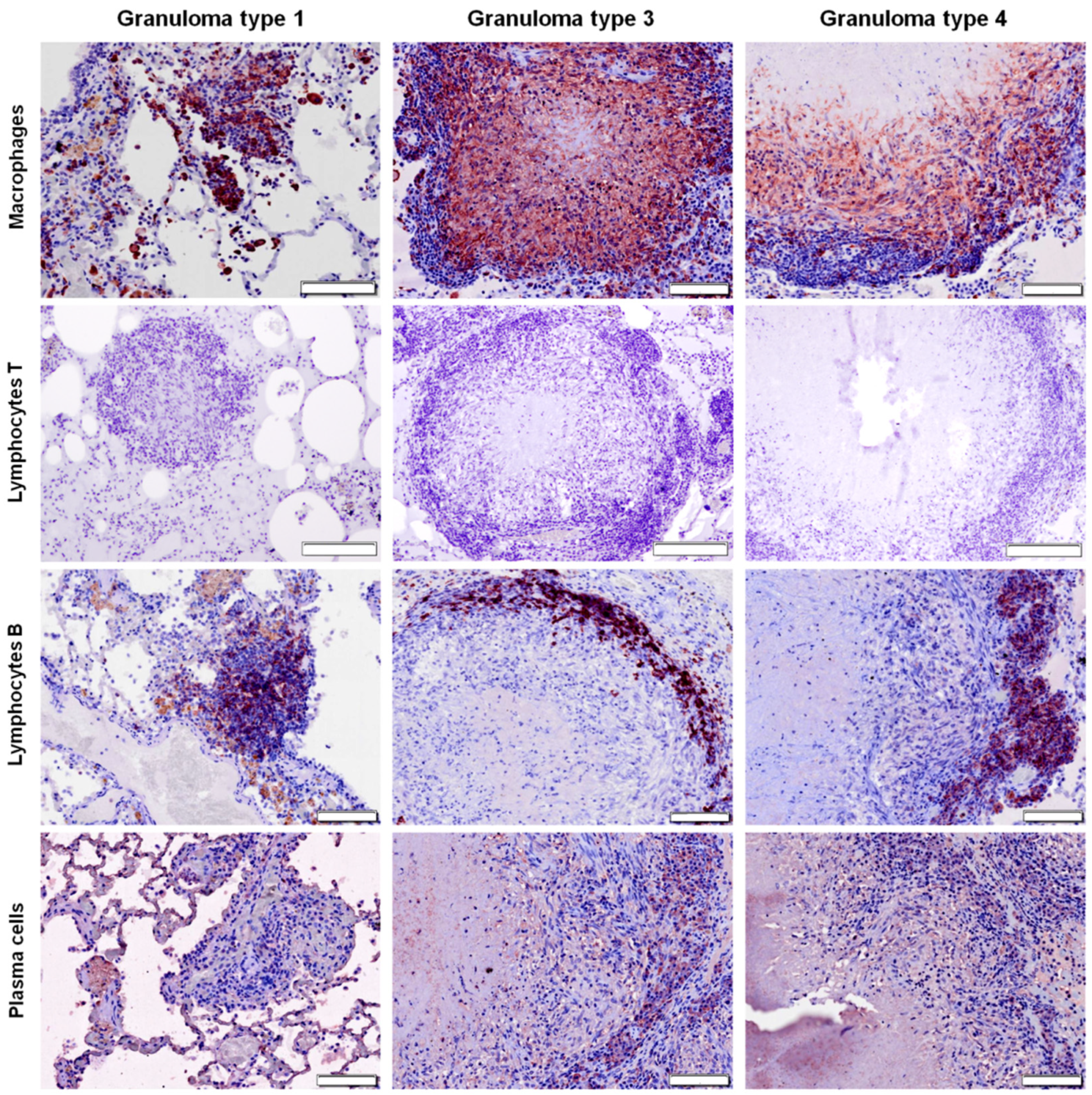 Pathogens 09 00456 g005