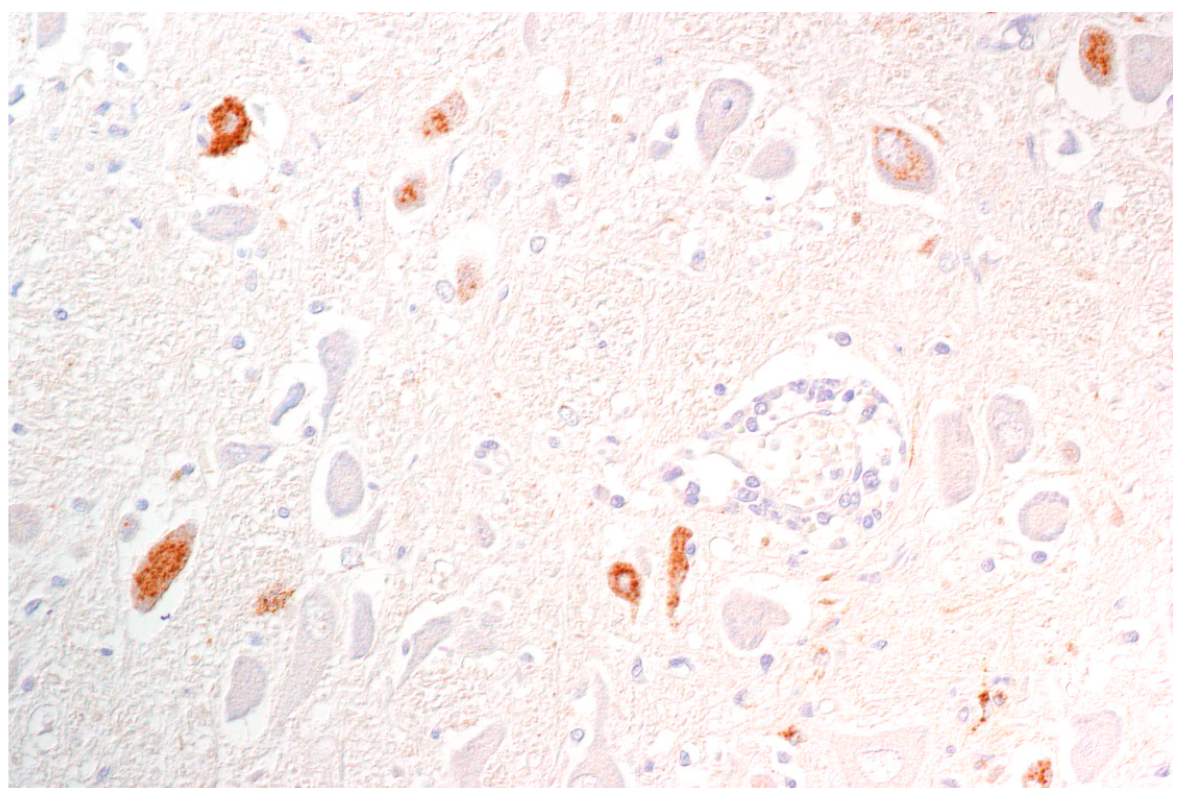 Pathogens 09 00633 g006 Pathogens 09 00633 g006