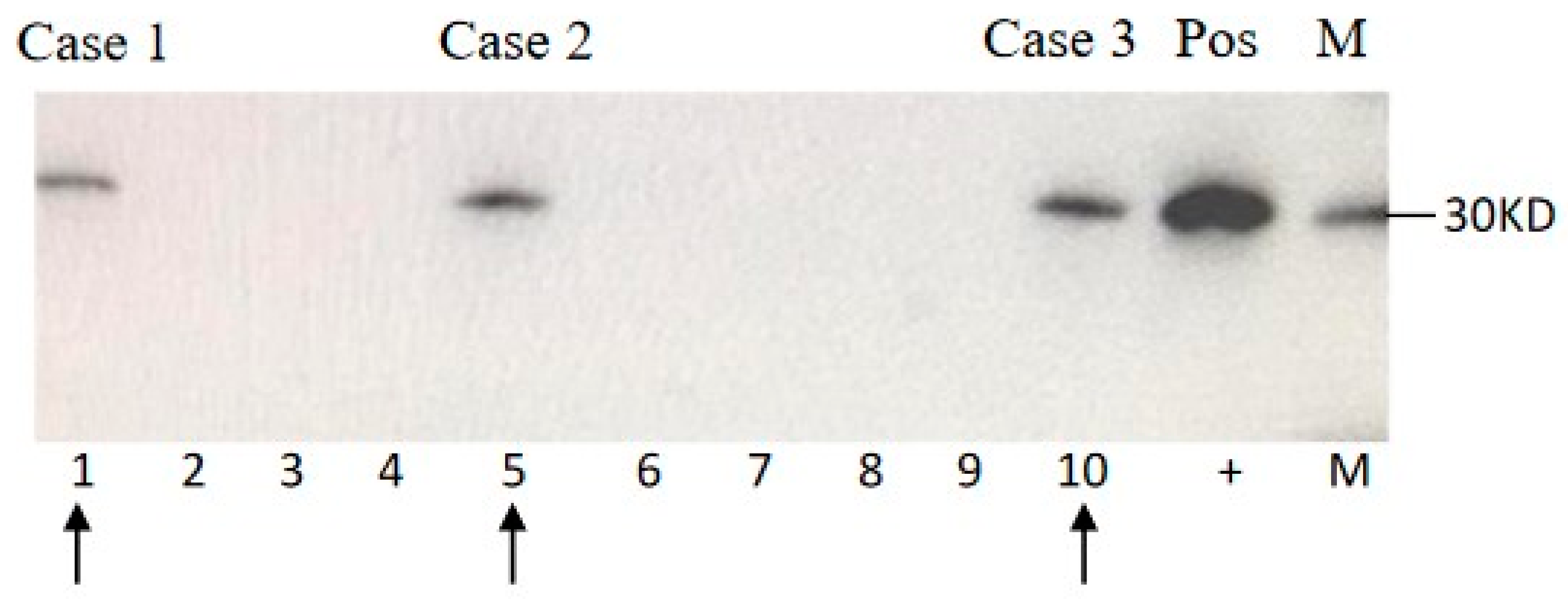 Pathogens 09 00800 g001 Pathogens 09 00800 g001