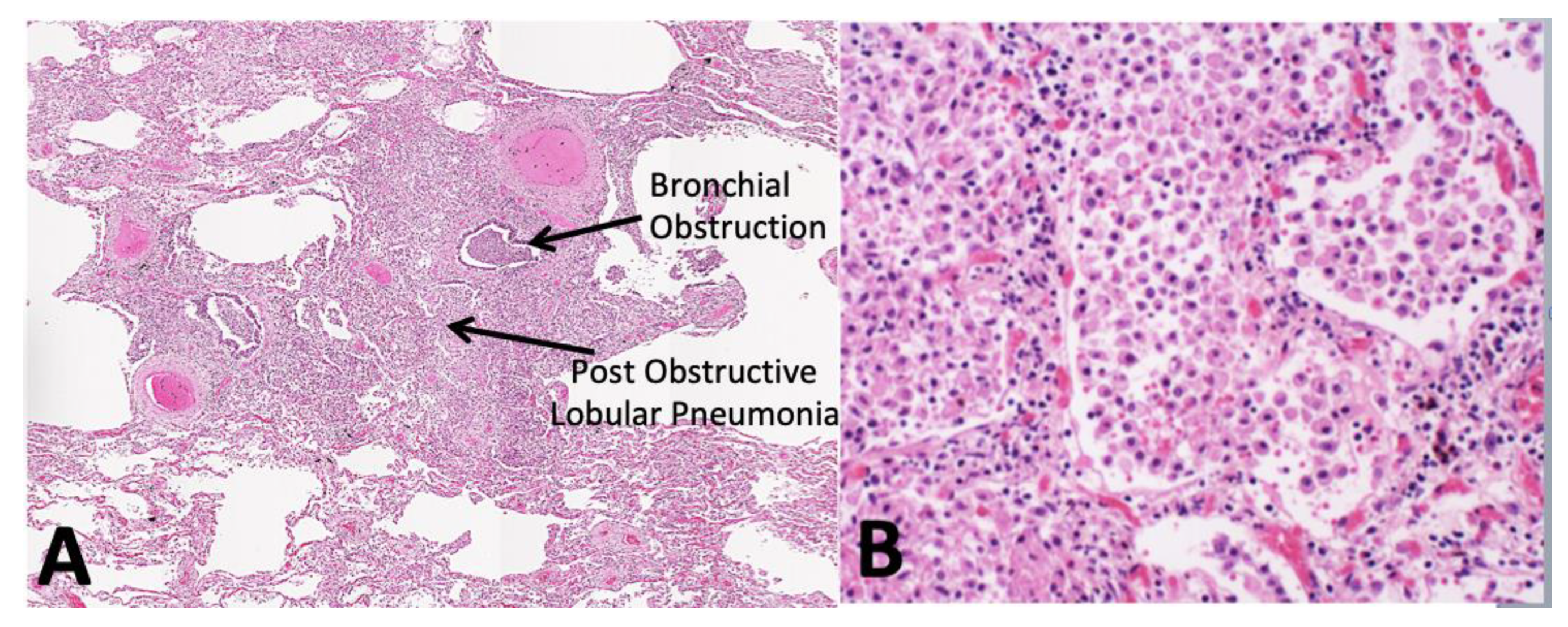 Pathogens 09 00813 g004