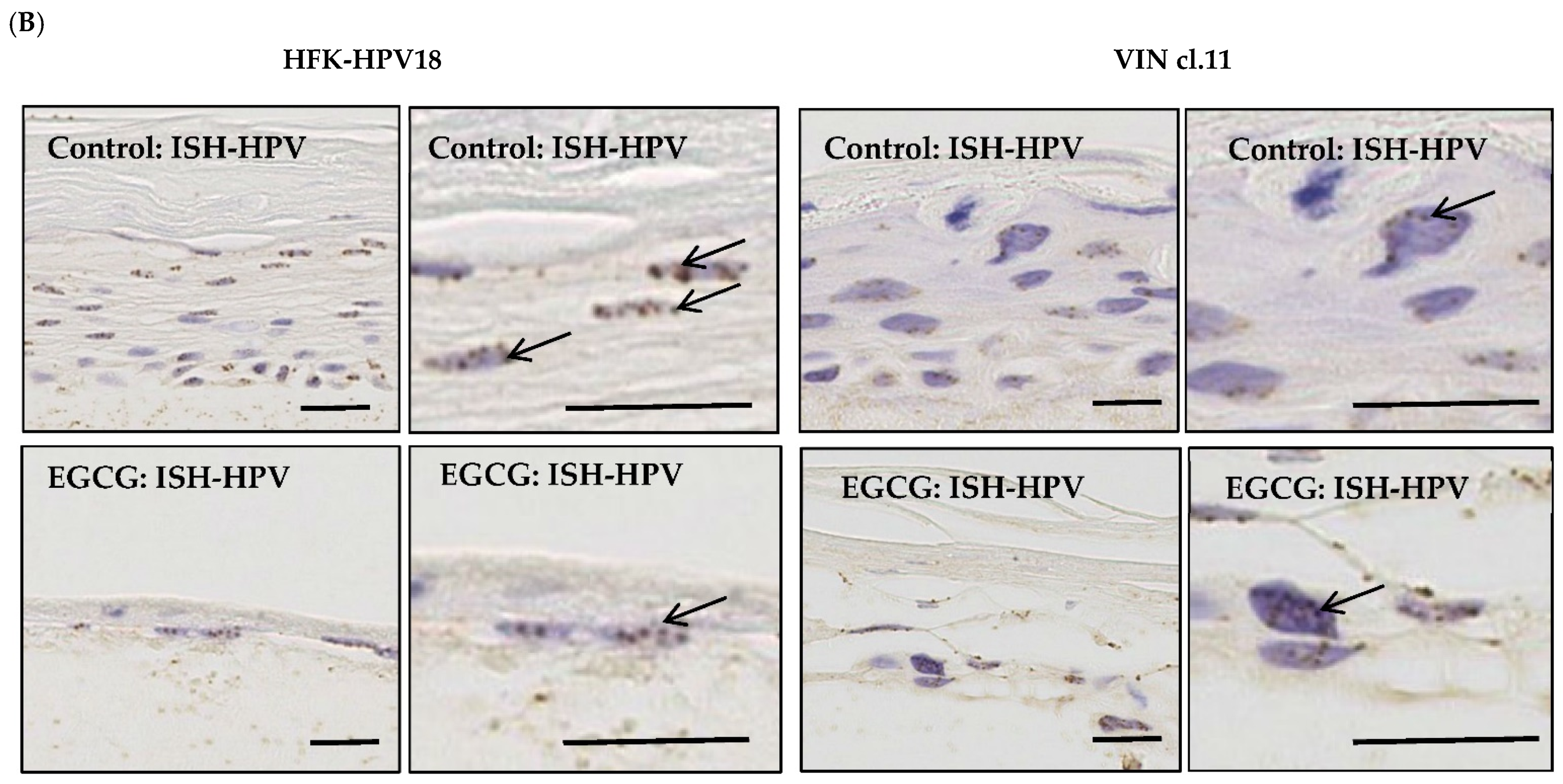 Pathogens 10 00459 g007b Pathogens 10 00459 g007b