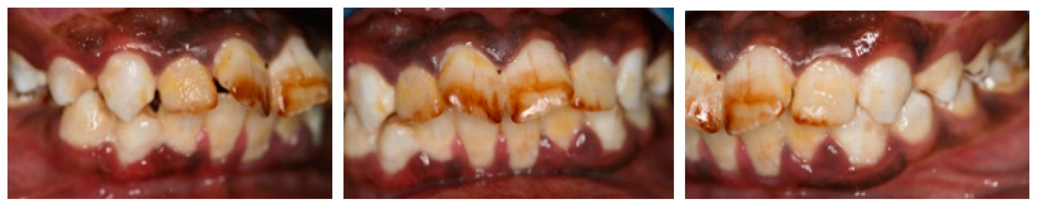 Pathogens 10 00488 g001