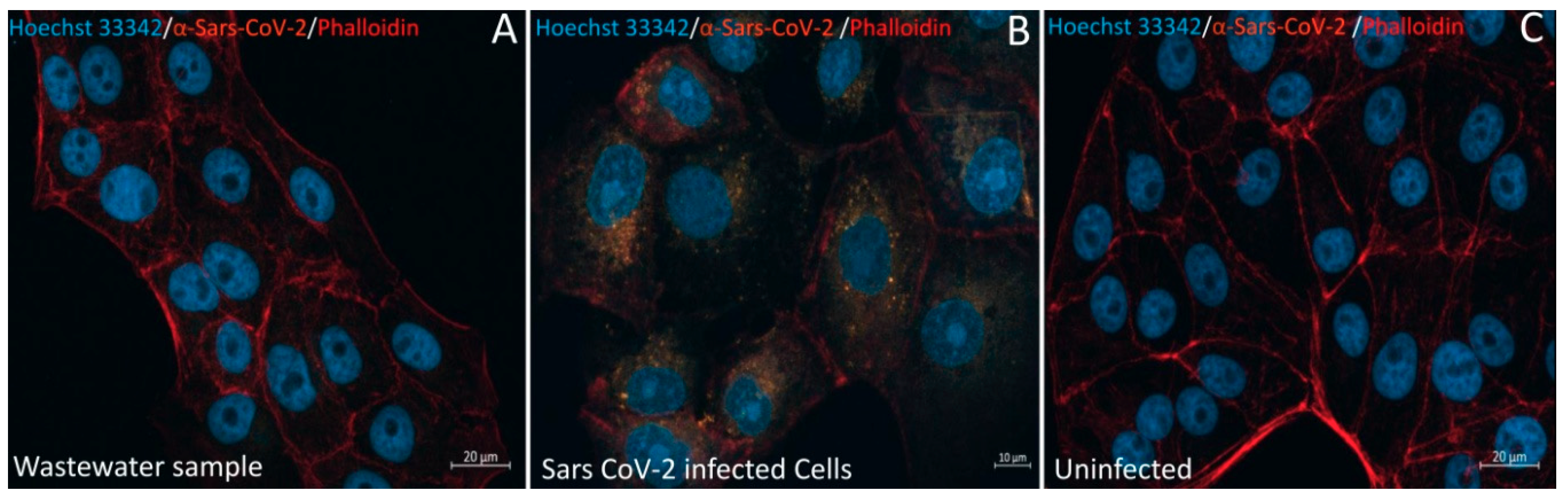 Pathogens 10 00516 g006 Pathogens 10 00516 g006