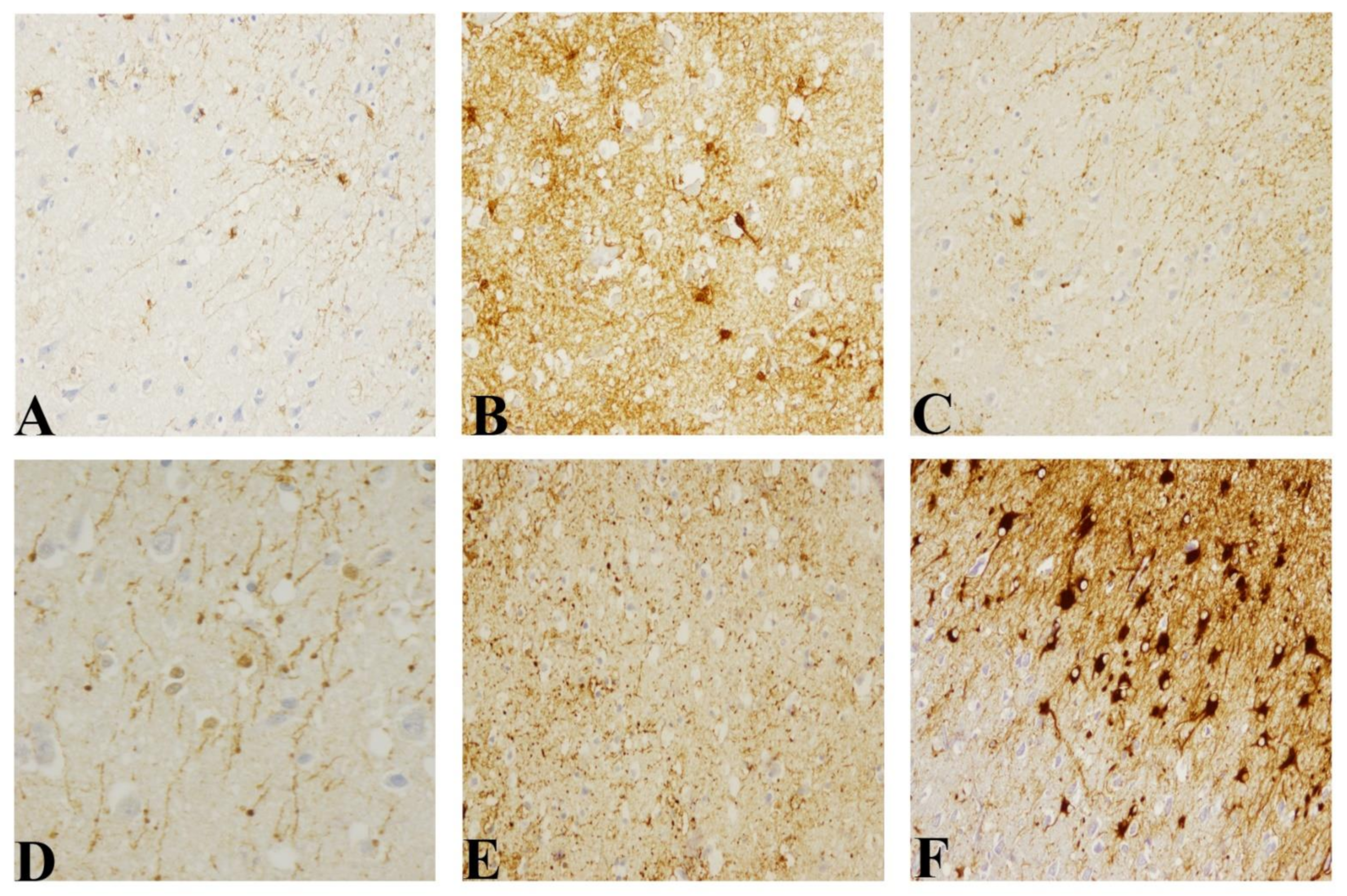 Pathogens 10 00596 g005 Pathogens 10 00596 g005