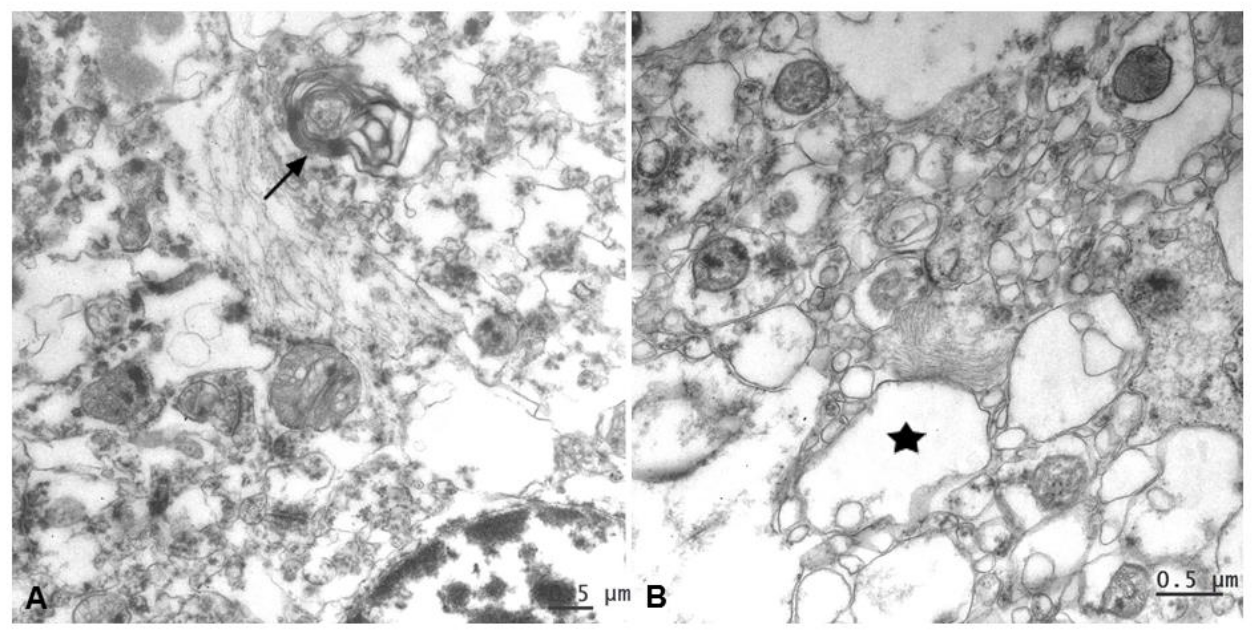 Pathogens 10 00596 g008 Pathogens 10 00596 g008