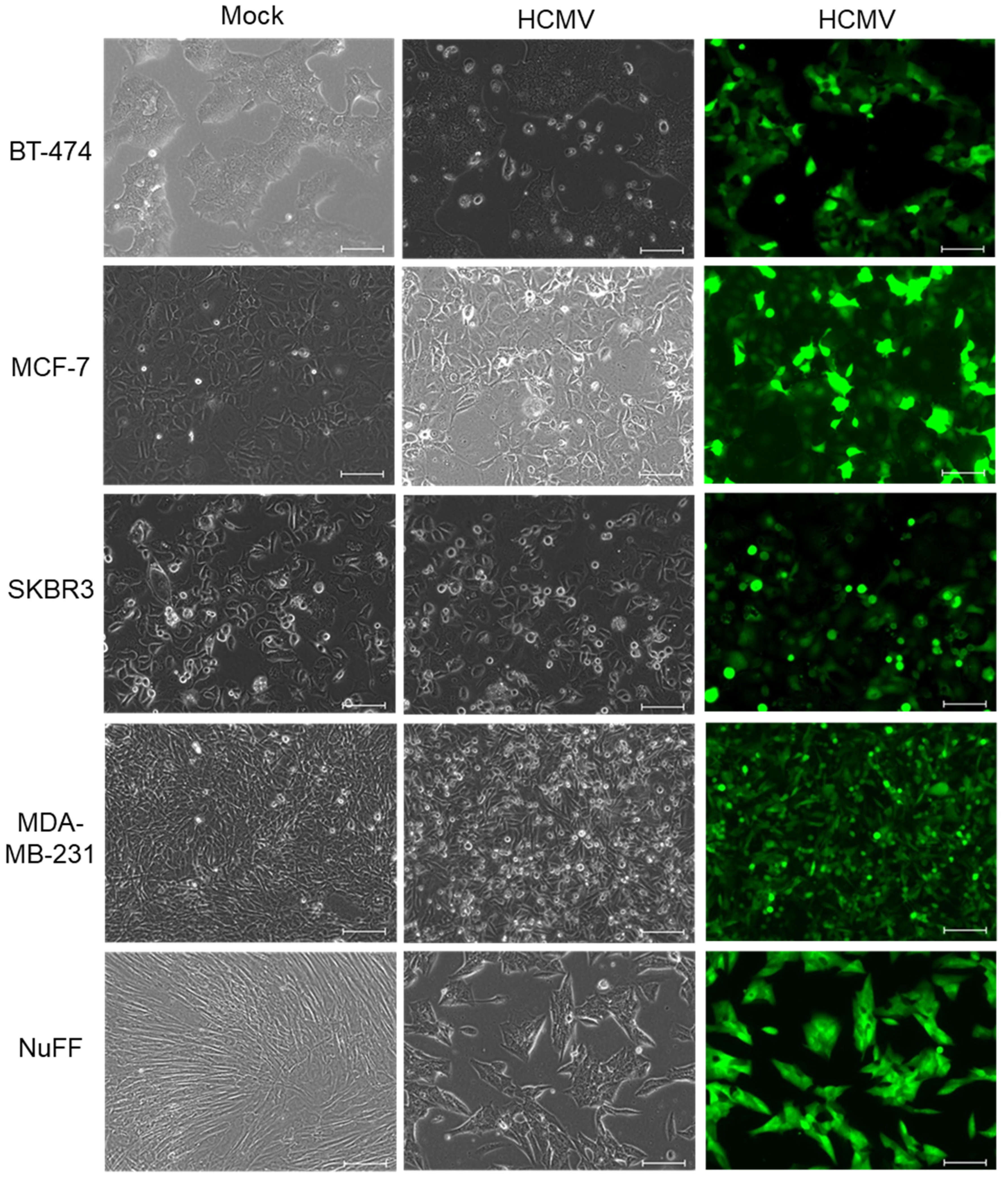 Pathogens 10 00641 g001
