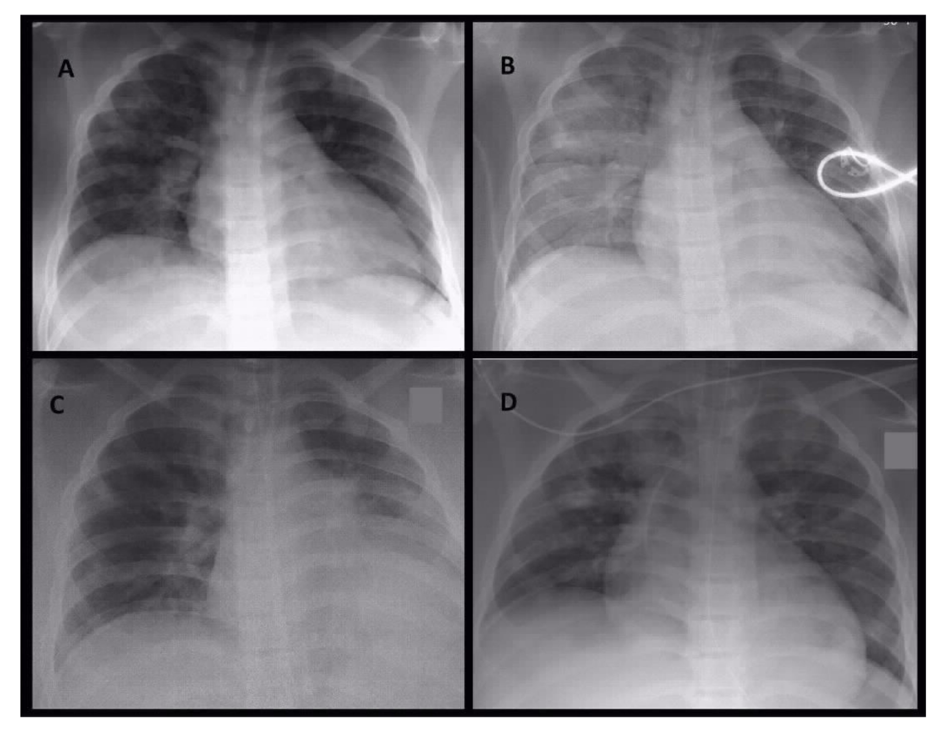 Pathogens 10 00733 g001 Pathogens 10 00733 g001