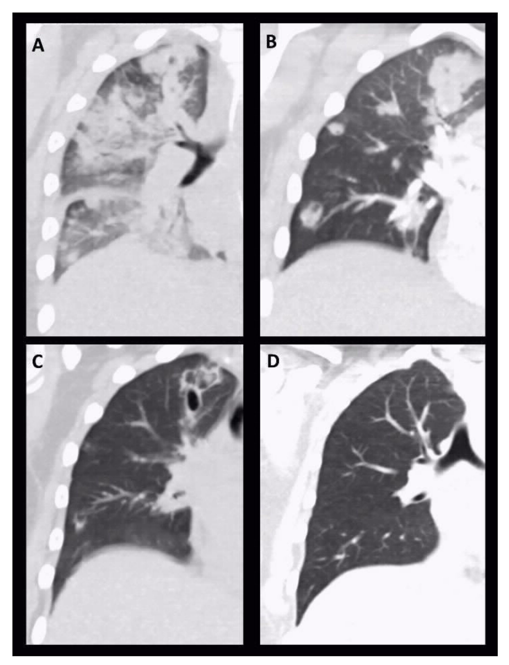 Pathogens 10 00733 g002 Pathogens 10 00733 g002