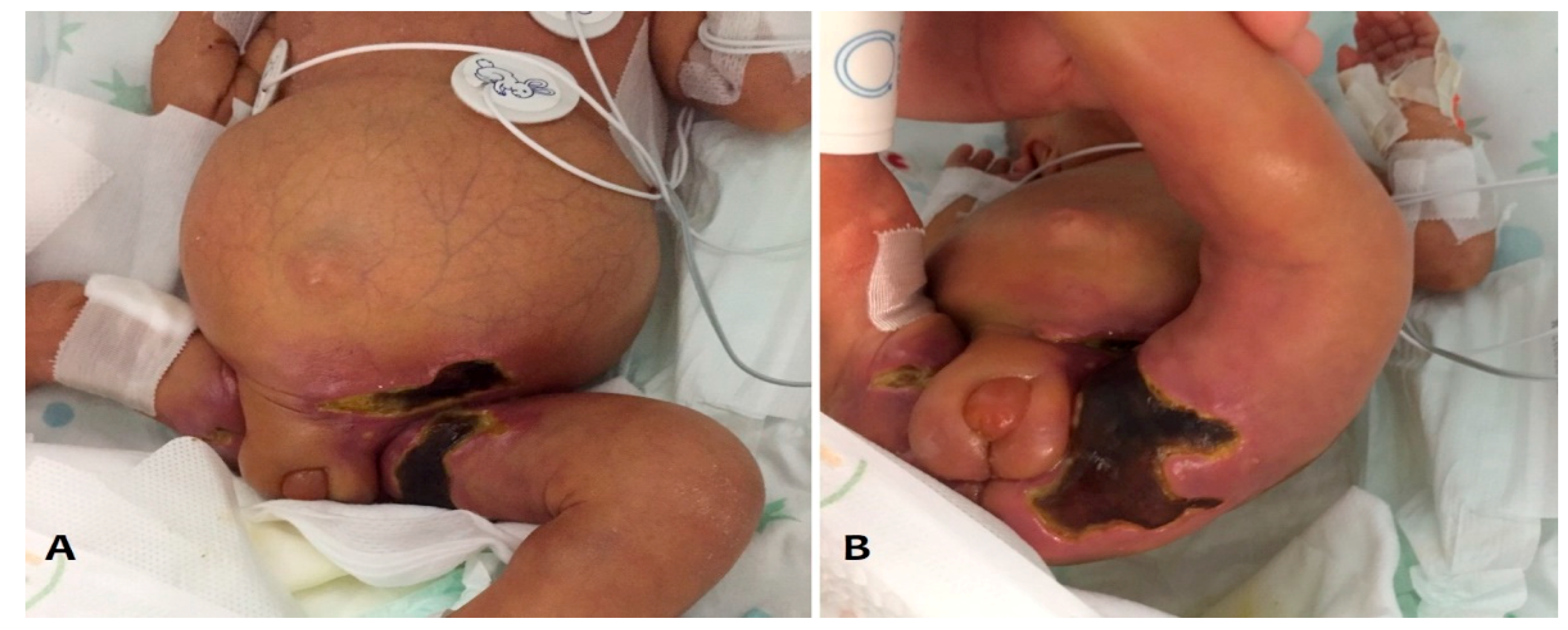 Pathogens 10 00890 g001