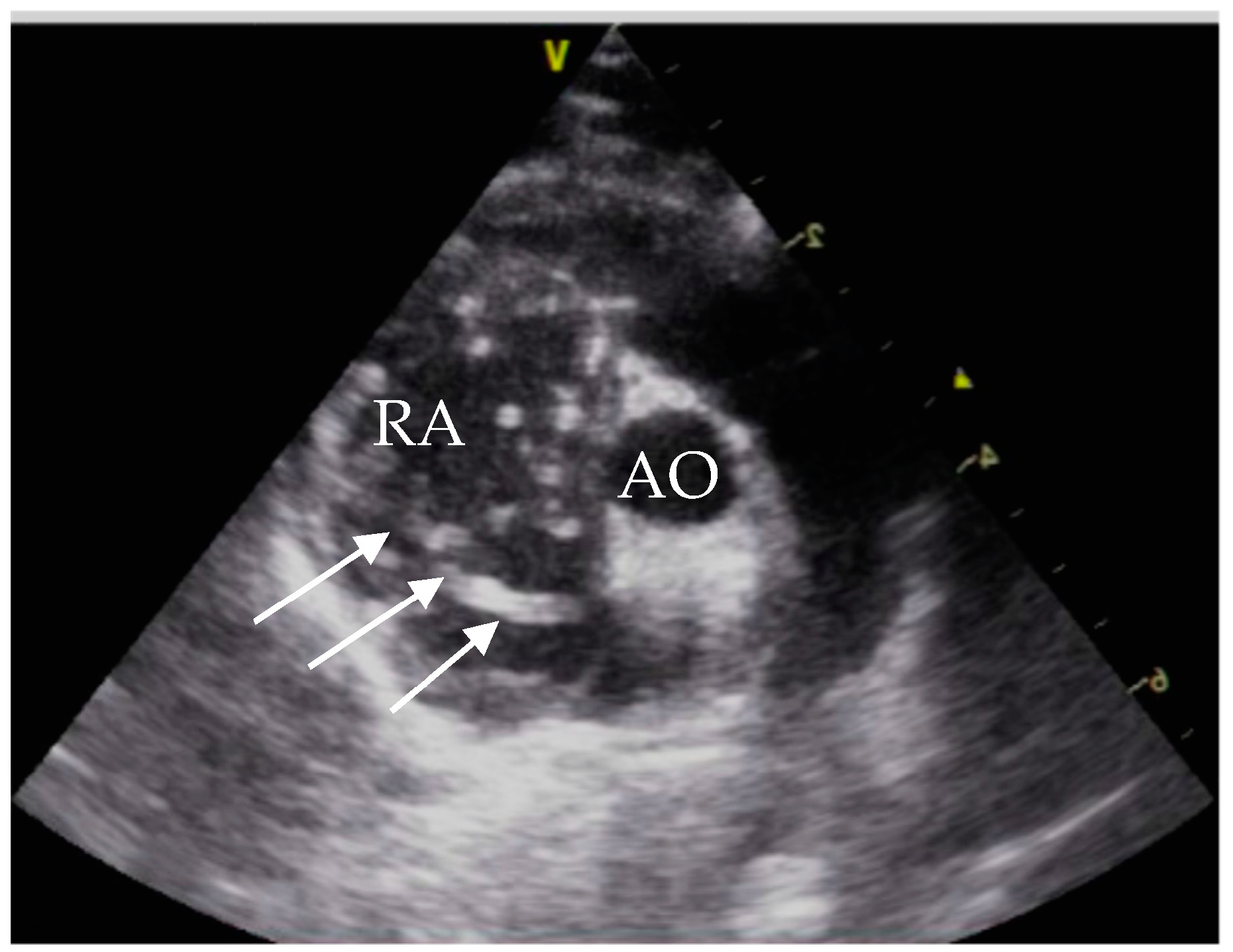 Pathogens 10 01104 g002