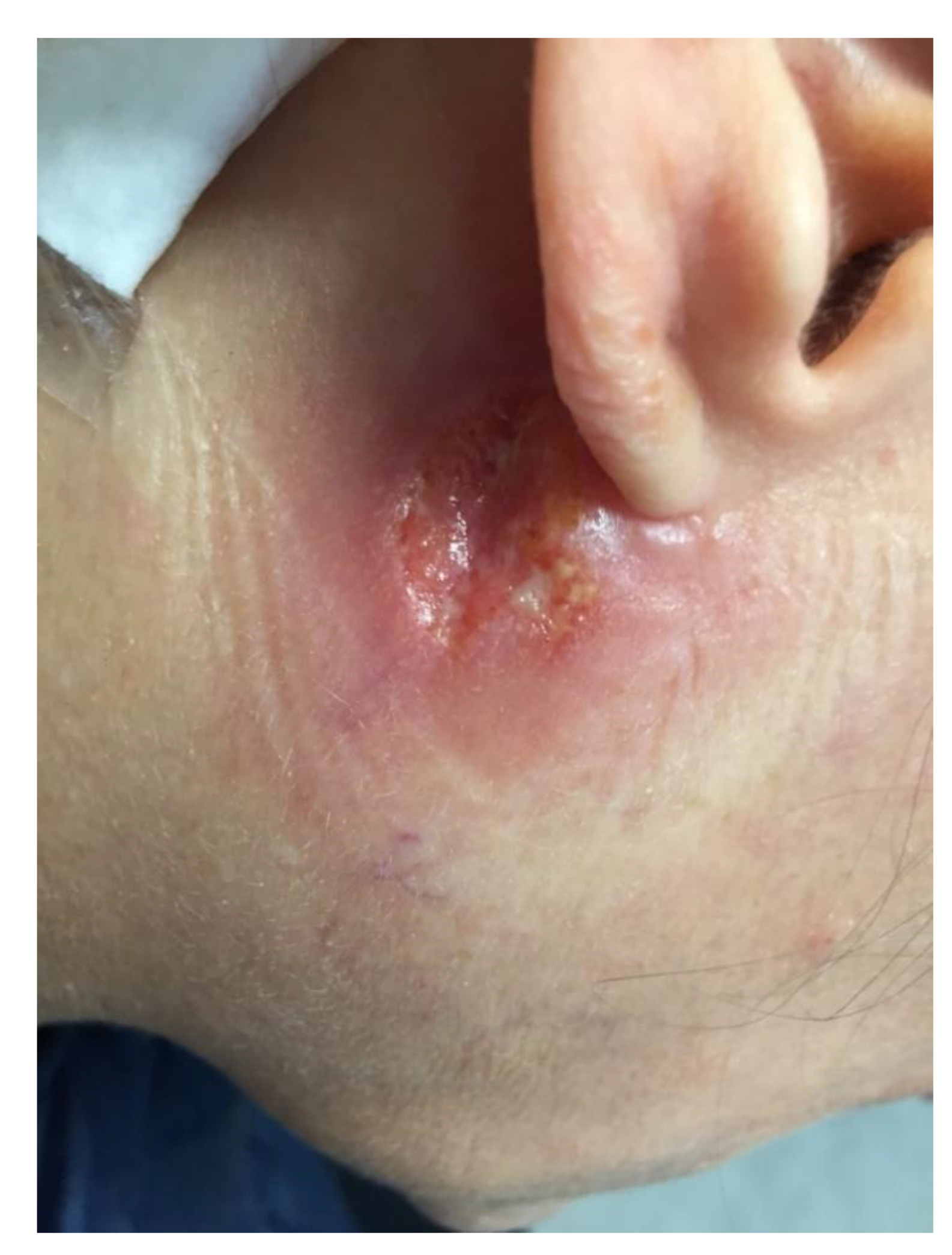 Pathogens 10 01112 g001