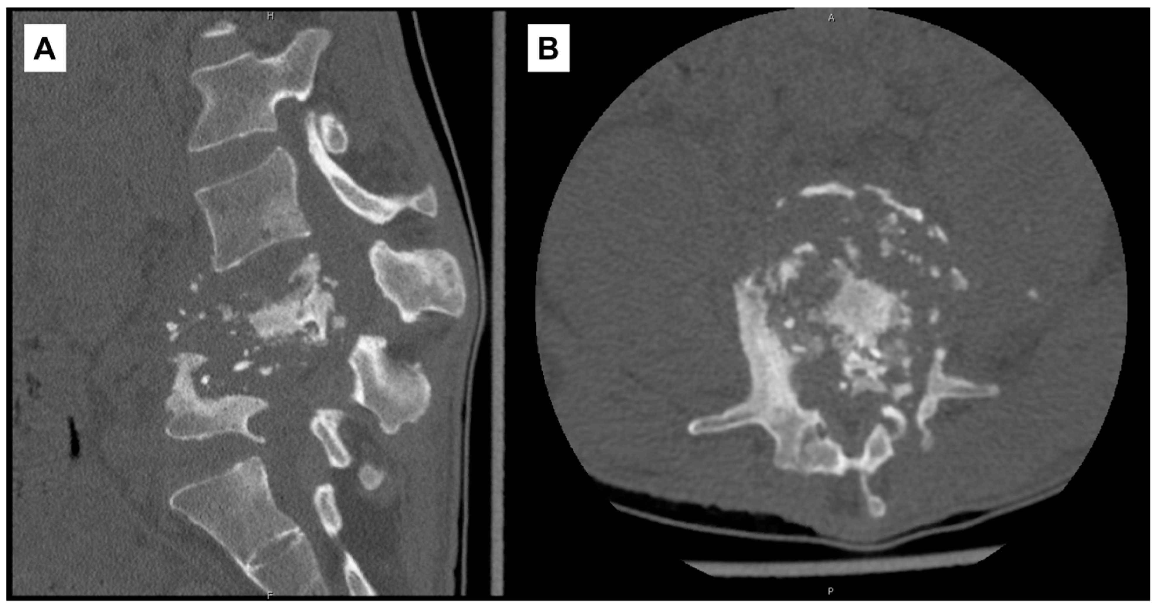 Pathogens 10 01158 g002