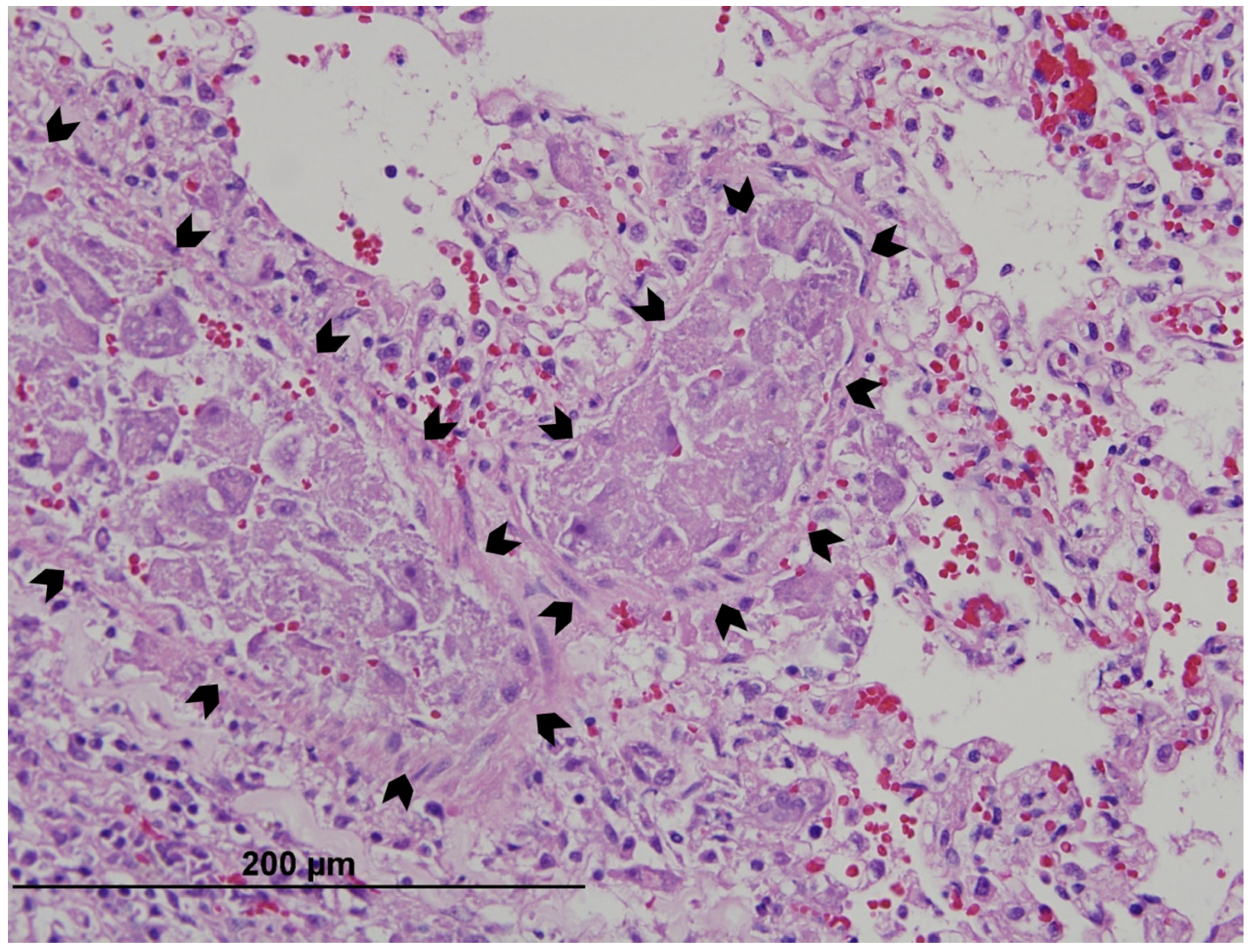 Pathogens 10 01170 g004