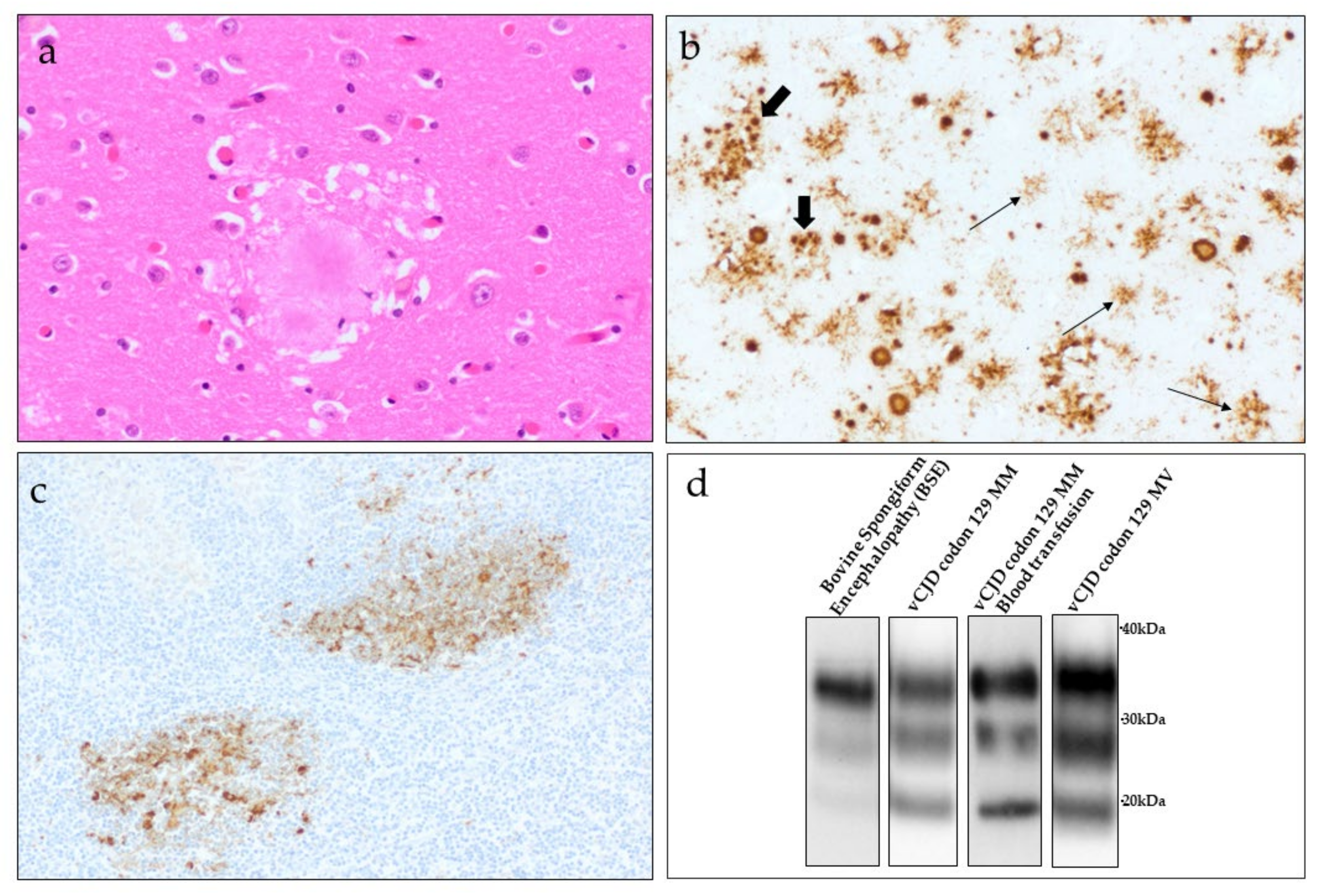 Pathogens 10 01413 g004