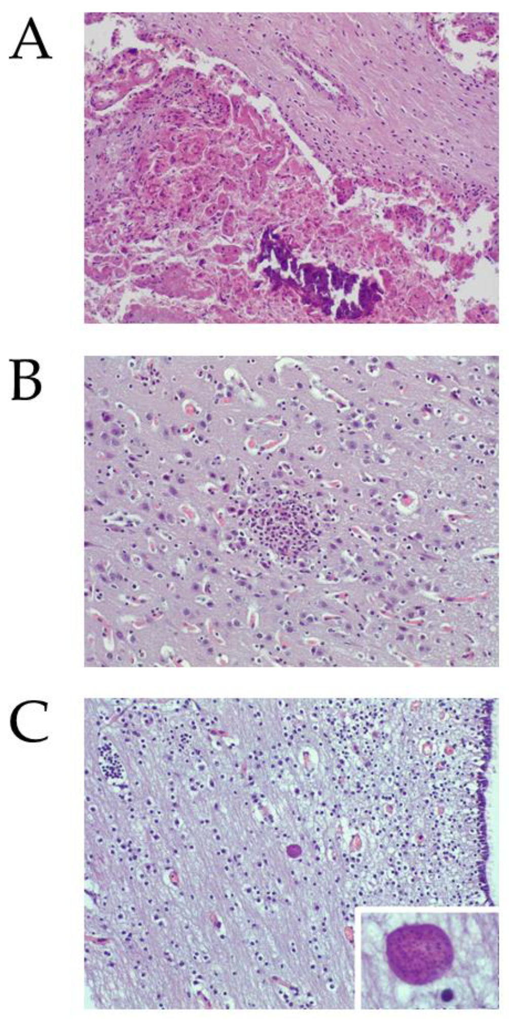 Pathogens 10 01518 g002 Pathogens 10 01518 g002