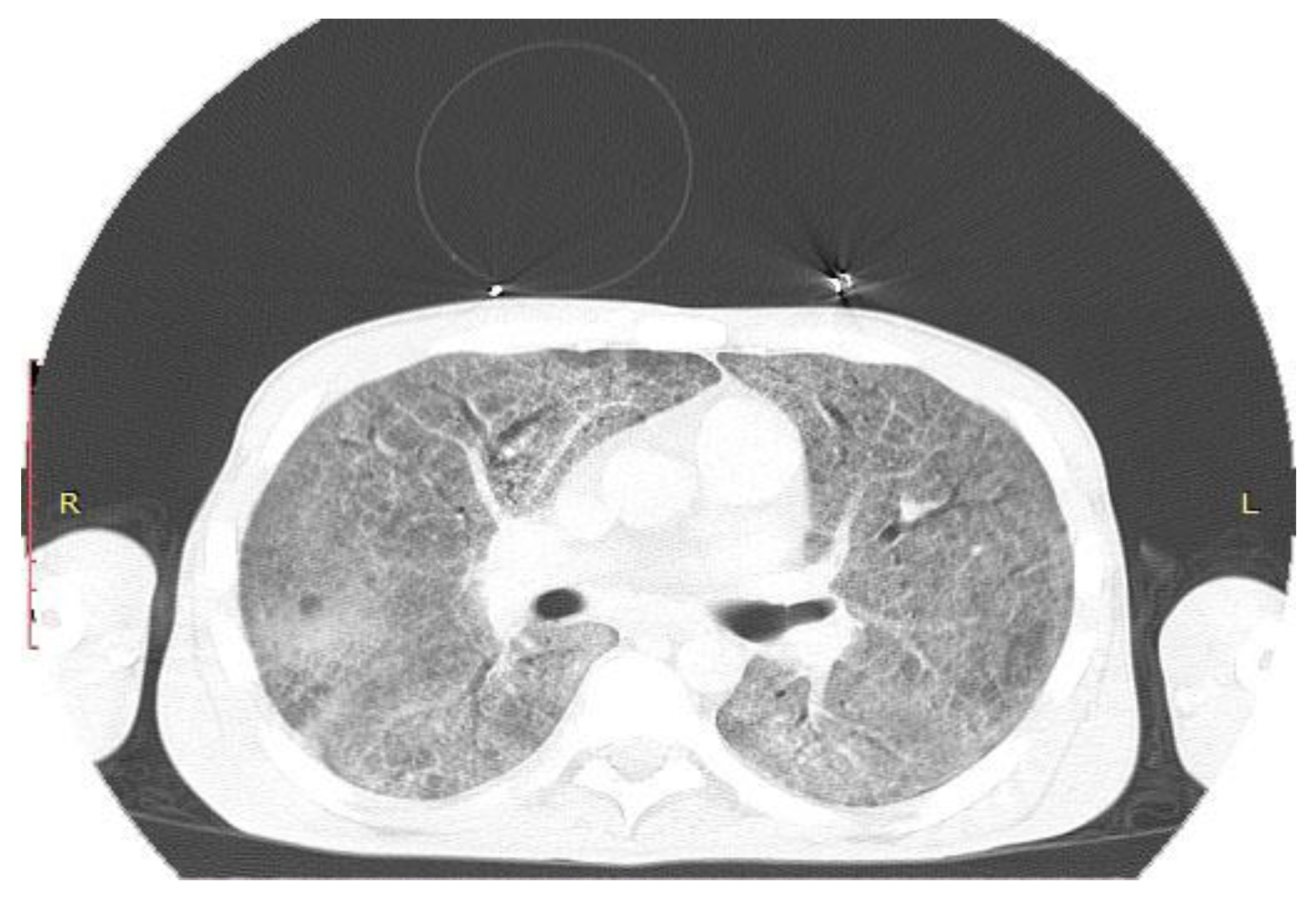 Pathogens 10 01523 g001