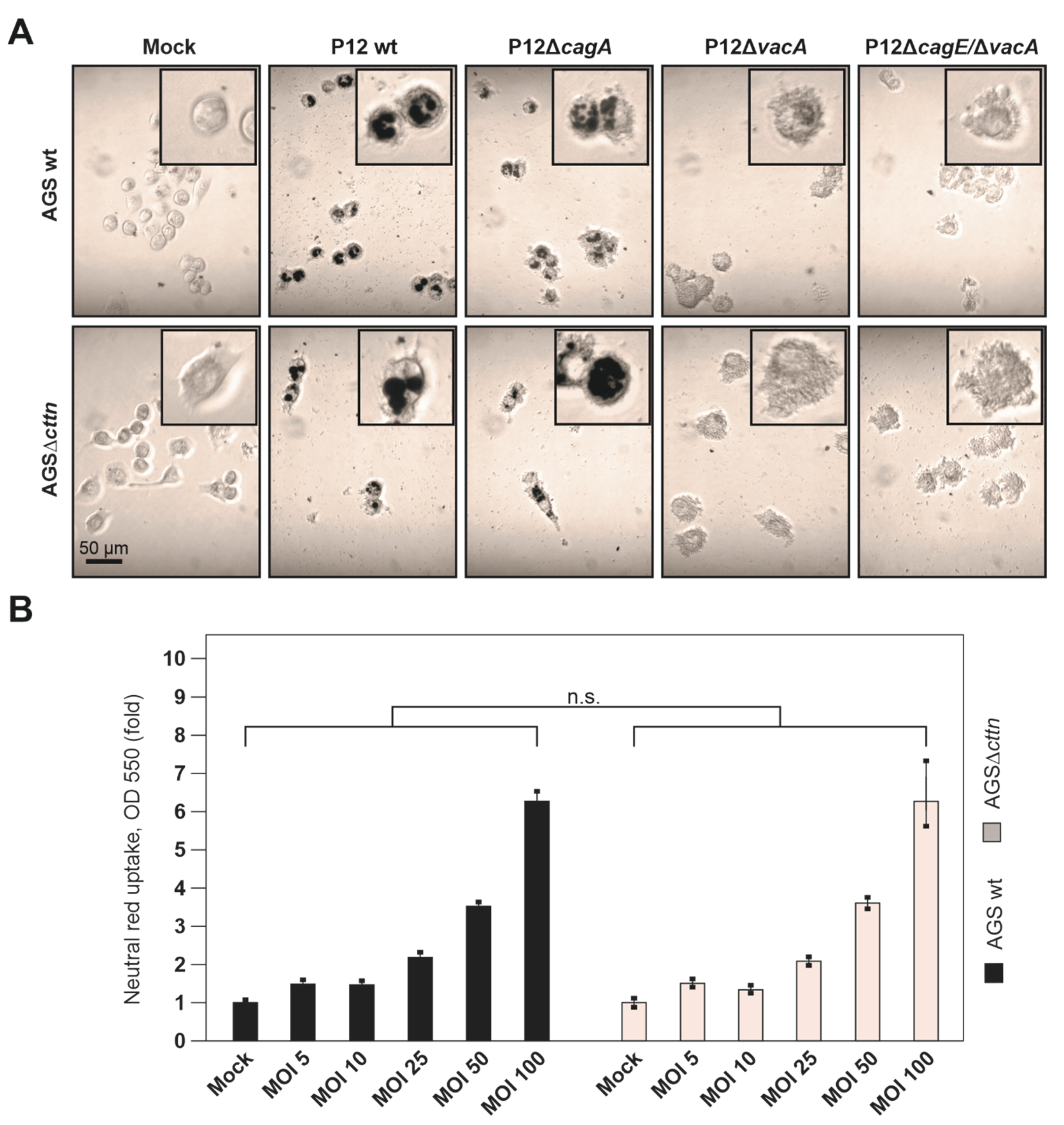 Pathogens 11 00003 g004