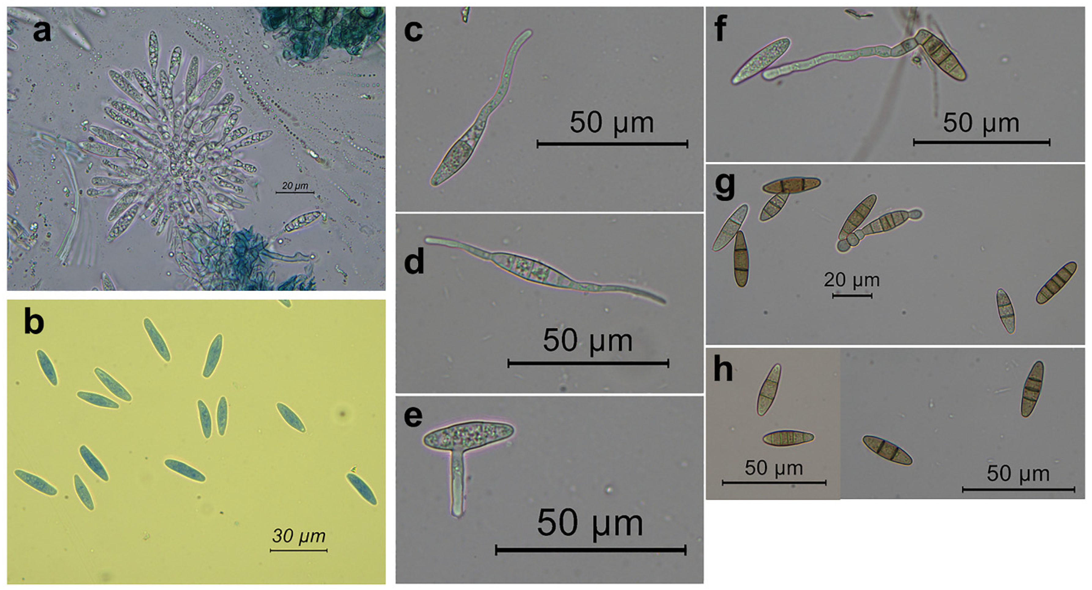 Pathogens 11 00053 g004