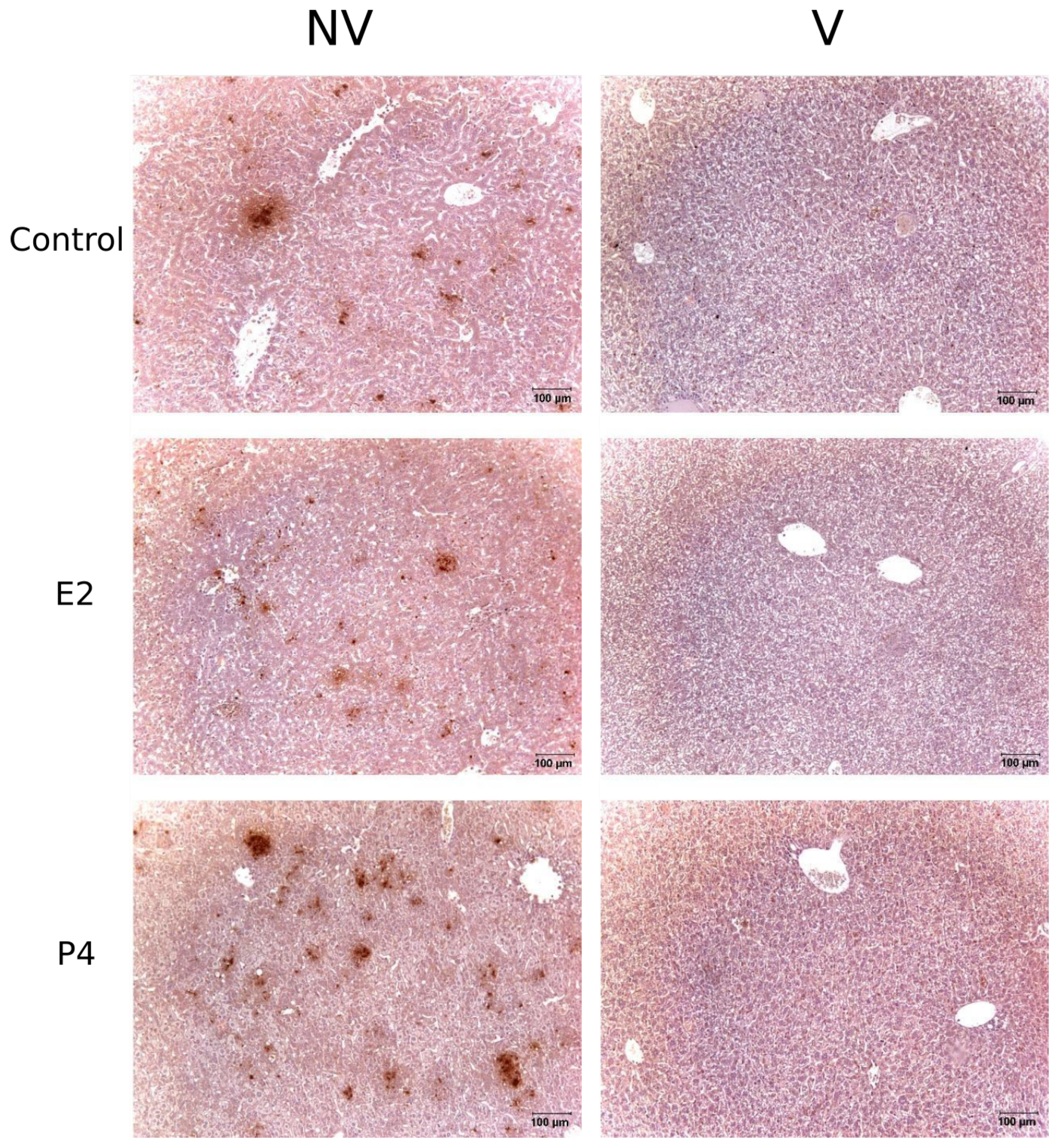 Pathogens 11 00093 g007