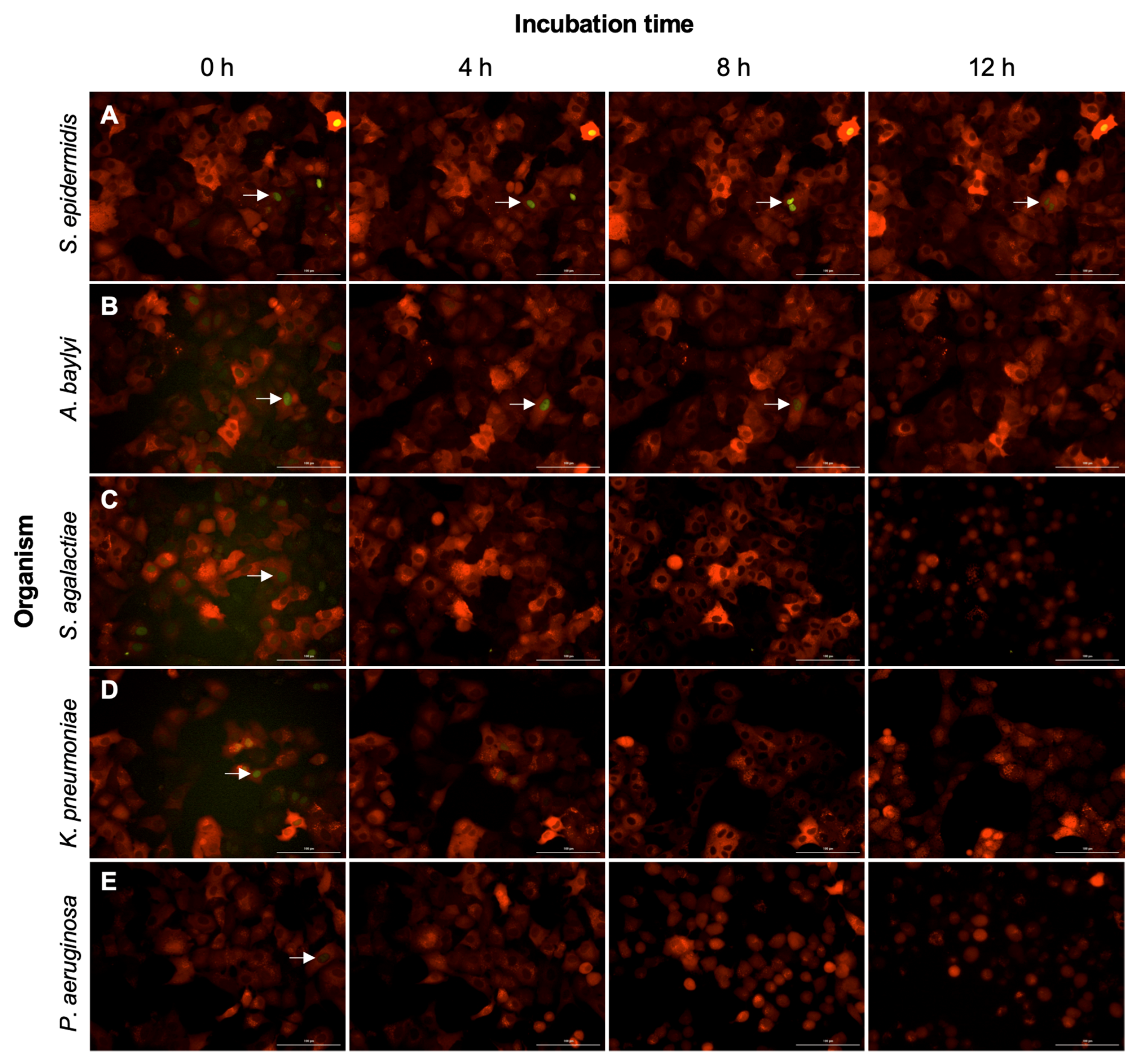 Pathogens 11 00209 g004