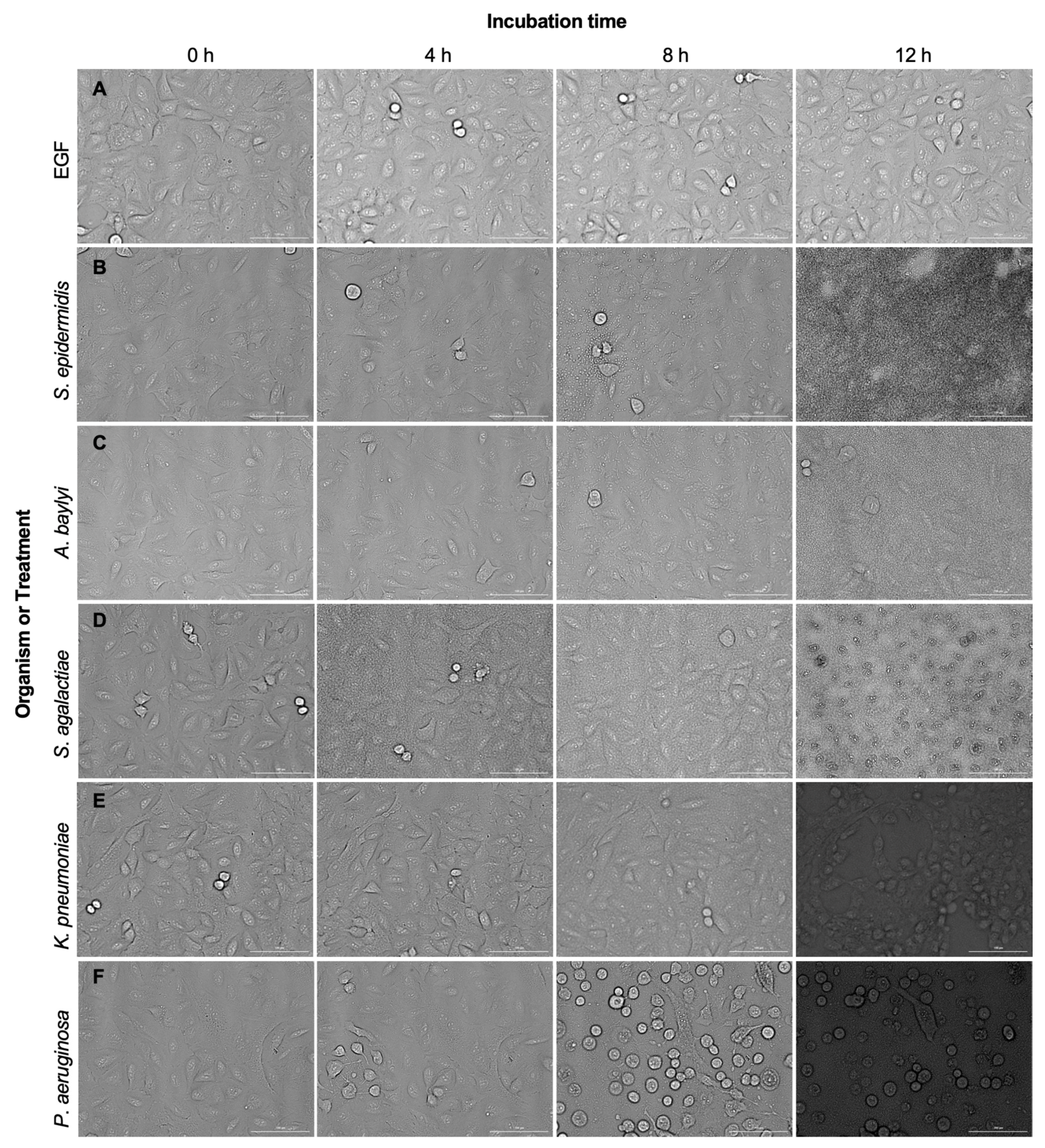 Pathogens 11 00209 g005