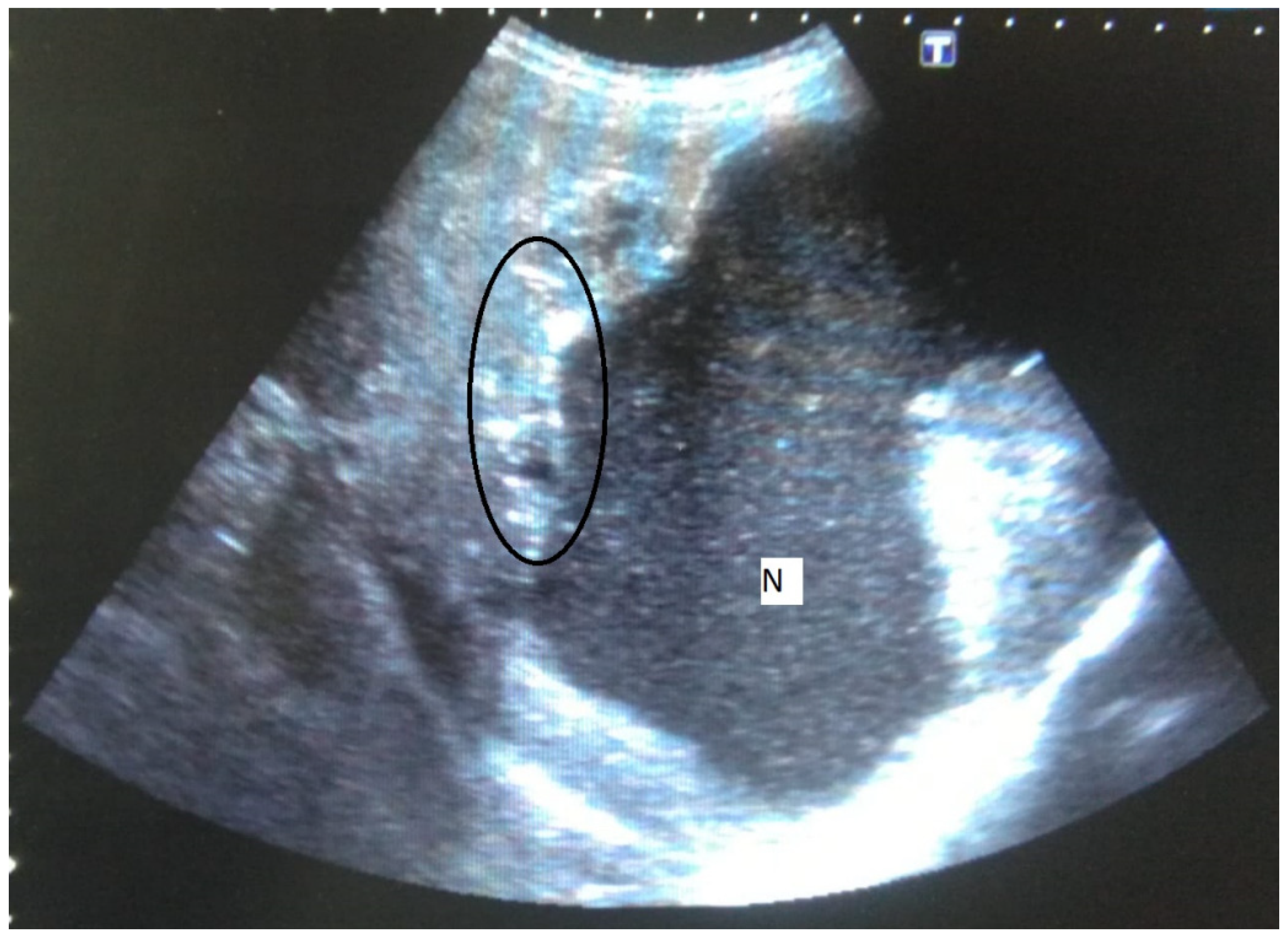 Pathogens 11 00276 g001