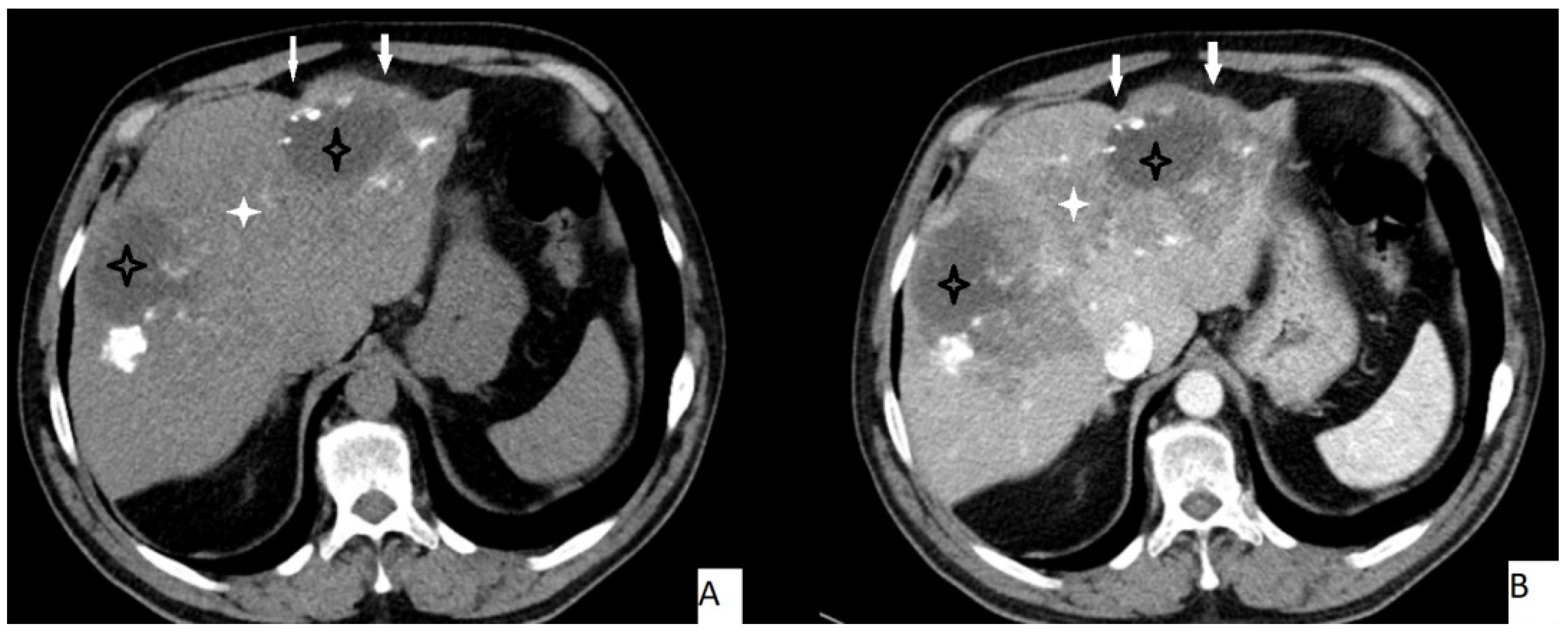 Pathogens 11 00276 g002